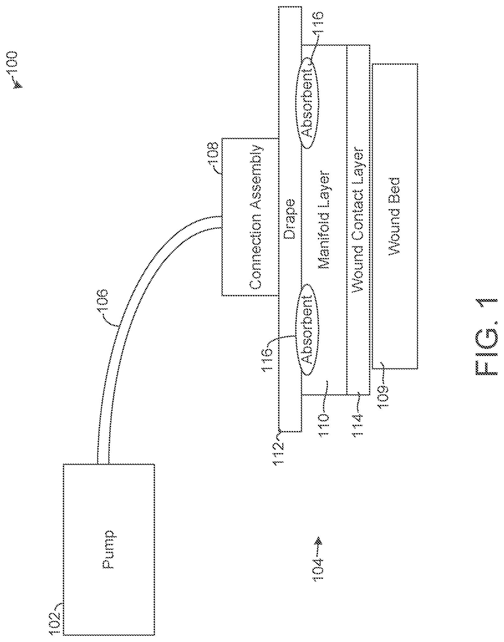 Patent US12102748 Figure 1 – Gel-blocking connection assembly for absorbent negative pressure dressing