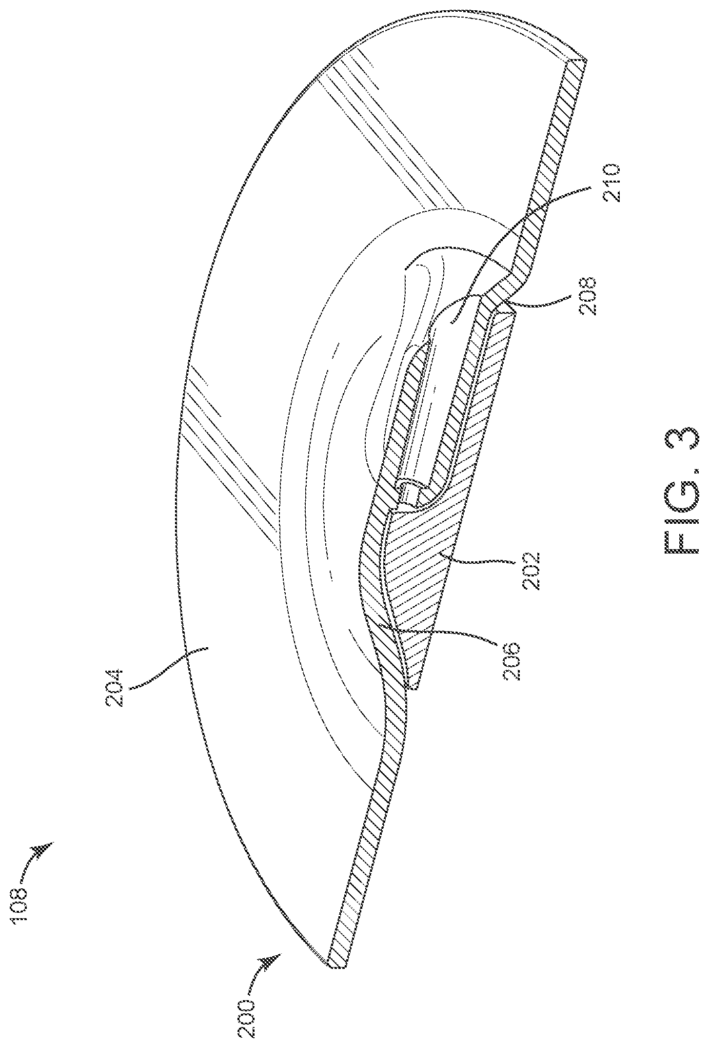 Patent US12102748 Figure 3 – Gel-blocking connection assembly for absorbent negative pressure dressing