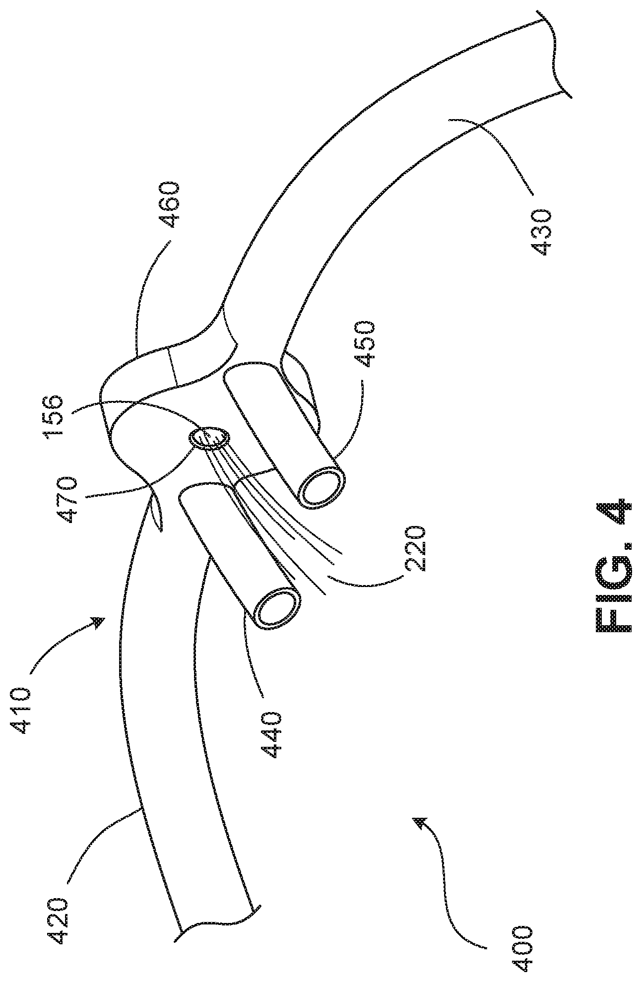 Patent US12102755 Figure 6 – Cannula-based vibrating mesh nebulizer