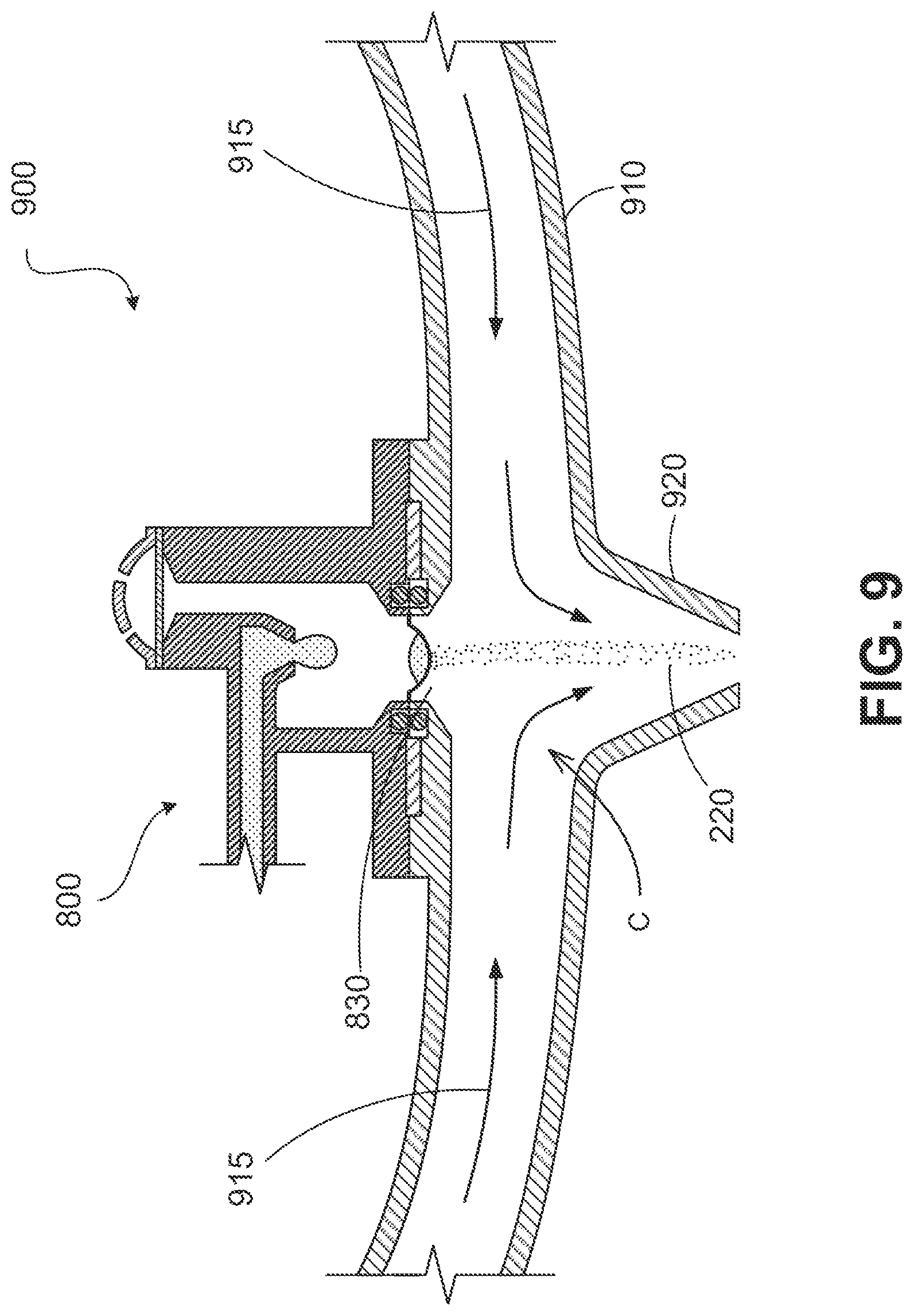 Patent US12102755 Figure 11 – Cannula-based vibrating mesh nebulizer