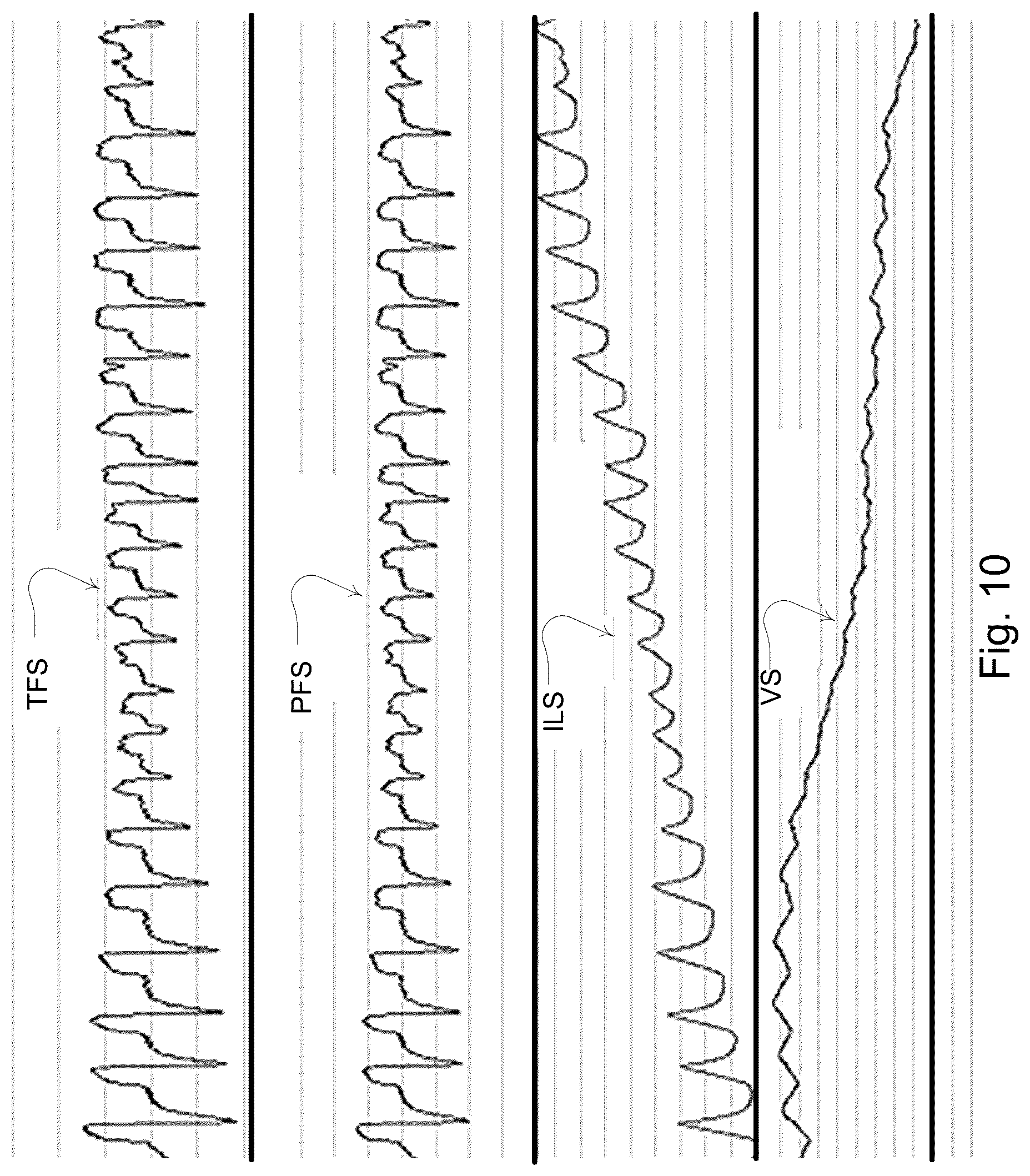 Patent US12102756 Figure 12 – Methods and devices with leak detection