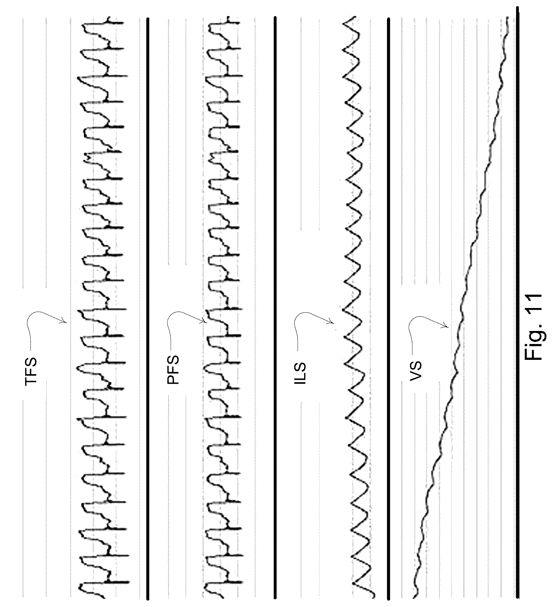 Patent US12102756 Figure 13 – Methods and devices with leak detection