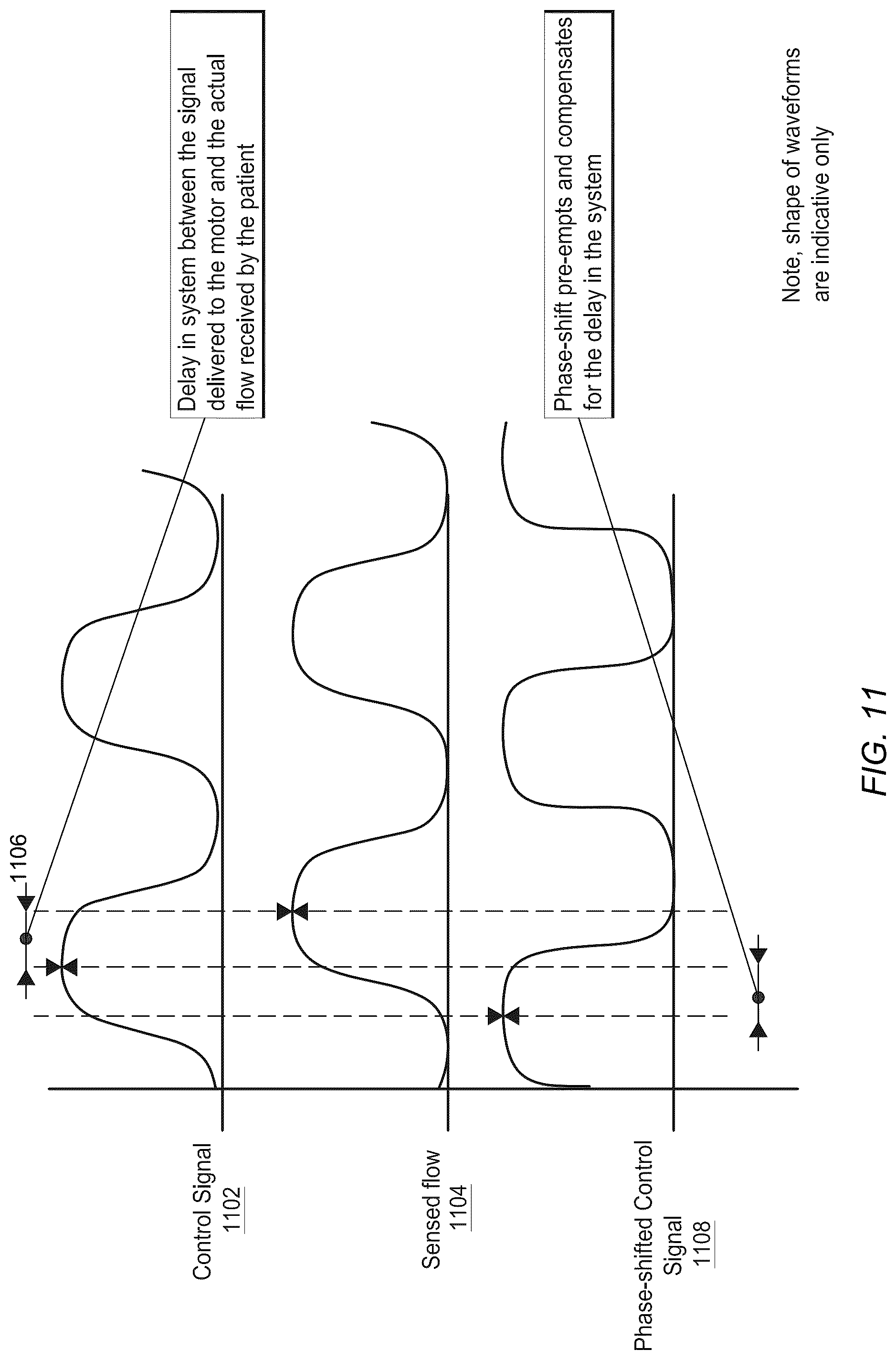 Patent US12102757 Figure 14 – Flow path sensing for flow therapy apparatus