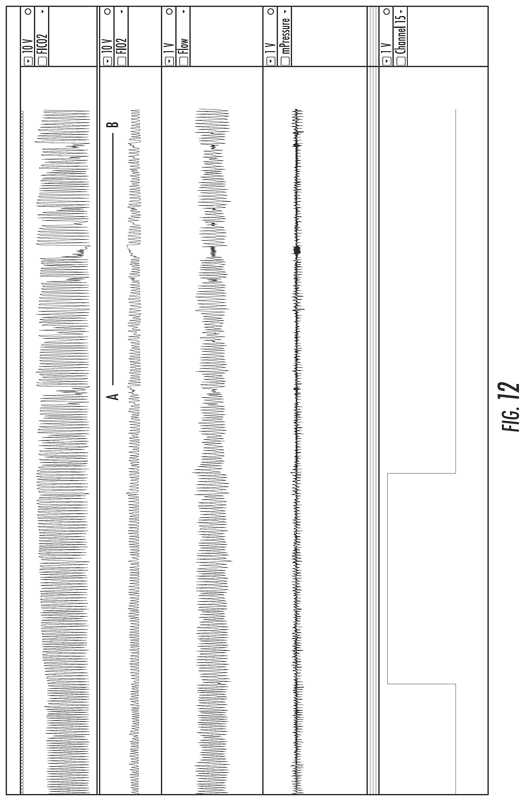 Patent US12102758 Figure 12 – Method and system for treating central sleep apnea
