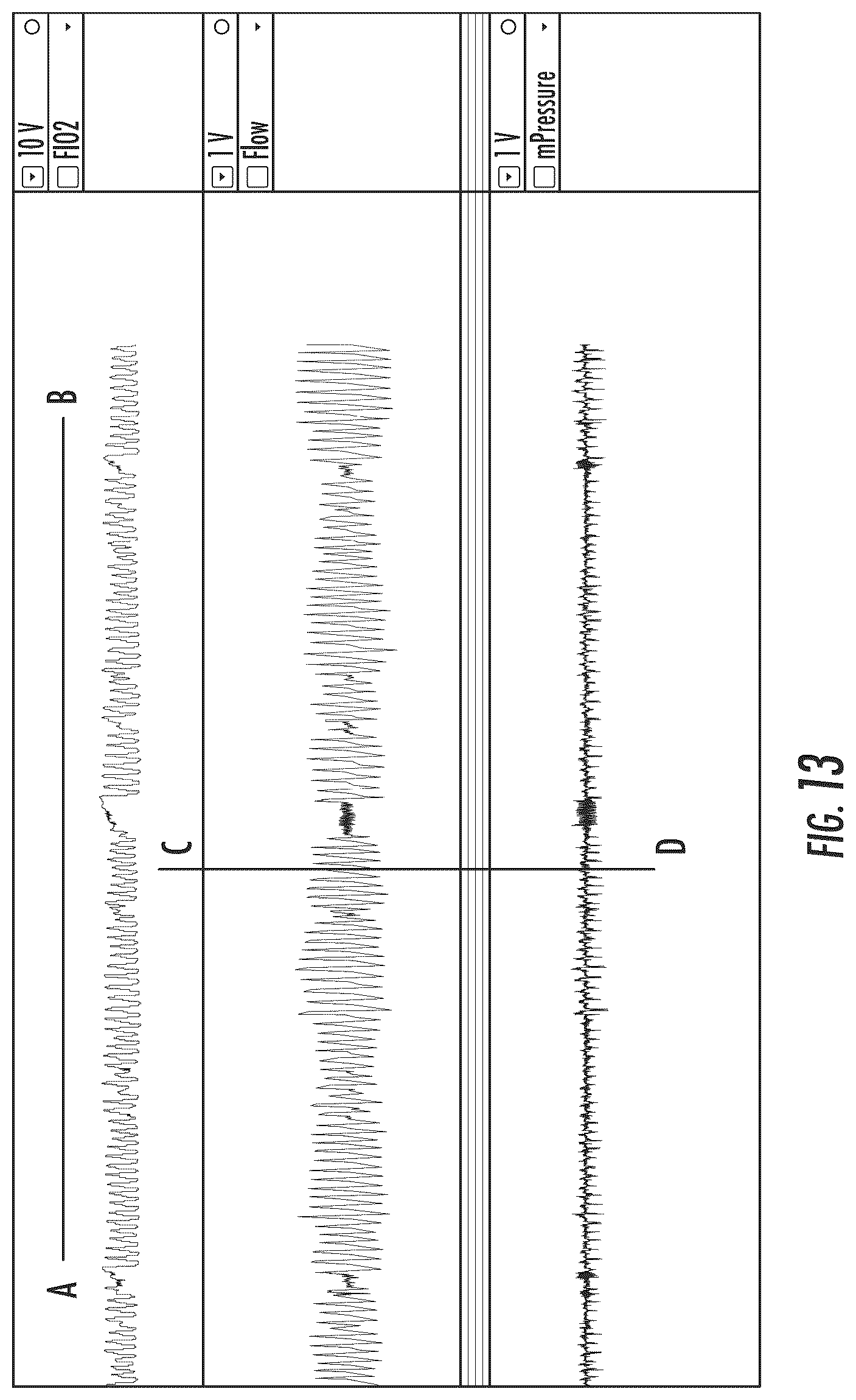 Patent US12102758 Figure 13 – Method and system for treating central sleep apnea
