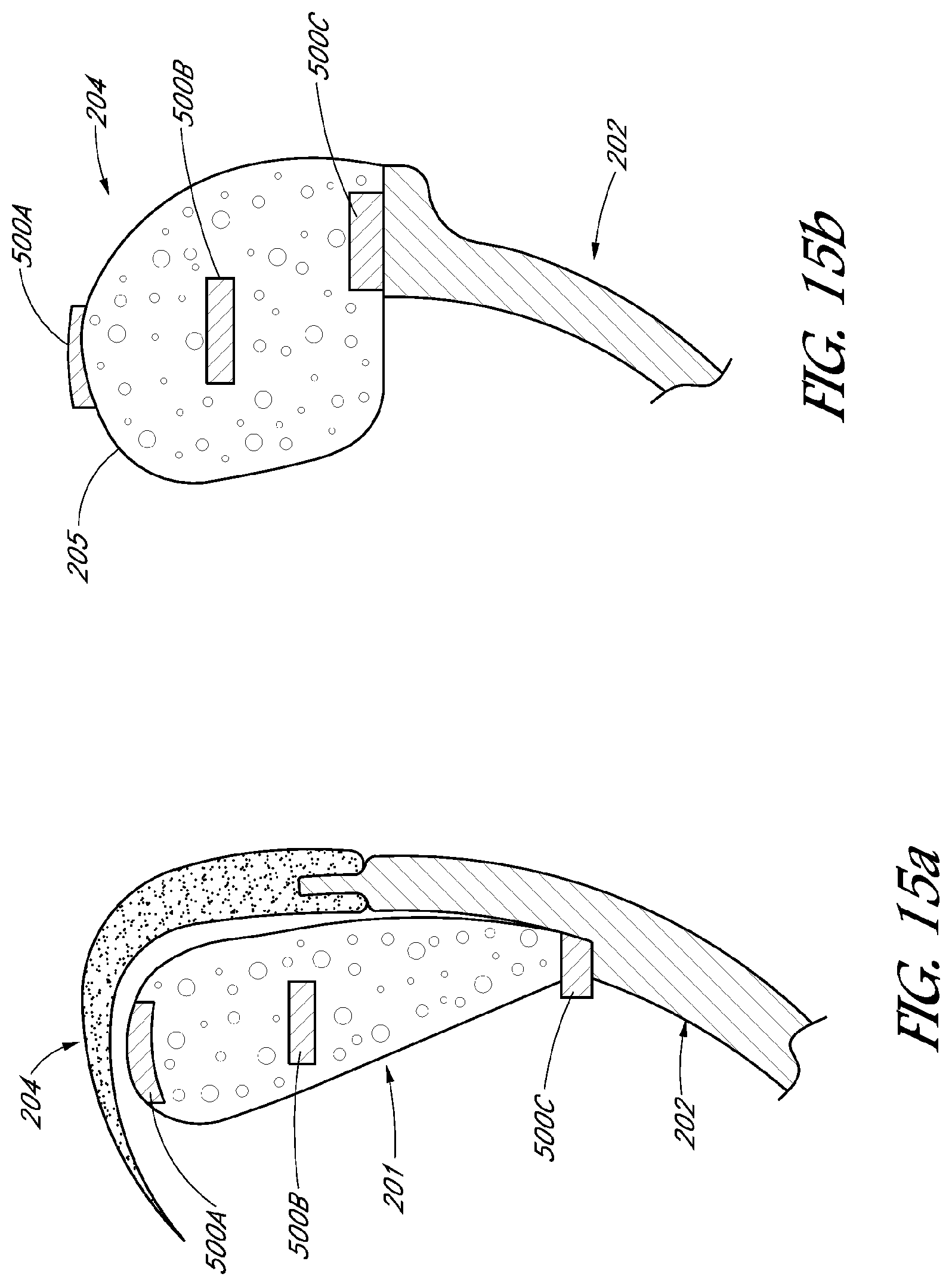 Patent US12102759 Figure 16 – Sealing force detection enabled, therapeutic fluid delivery device