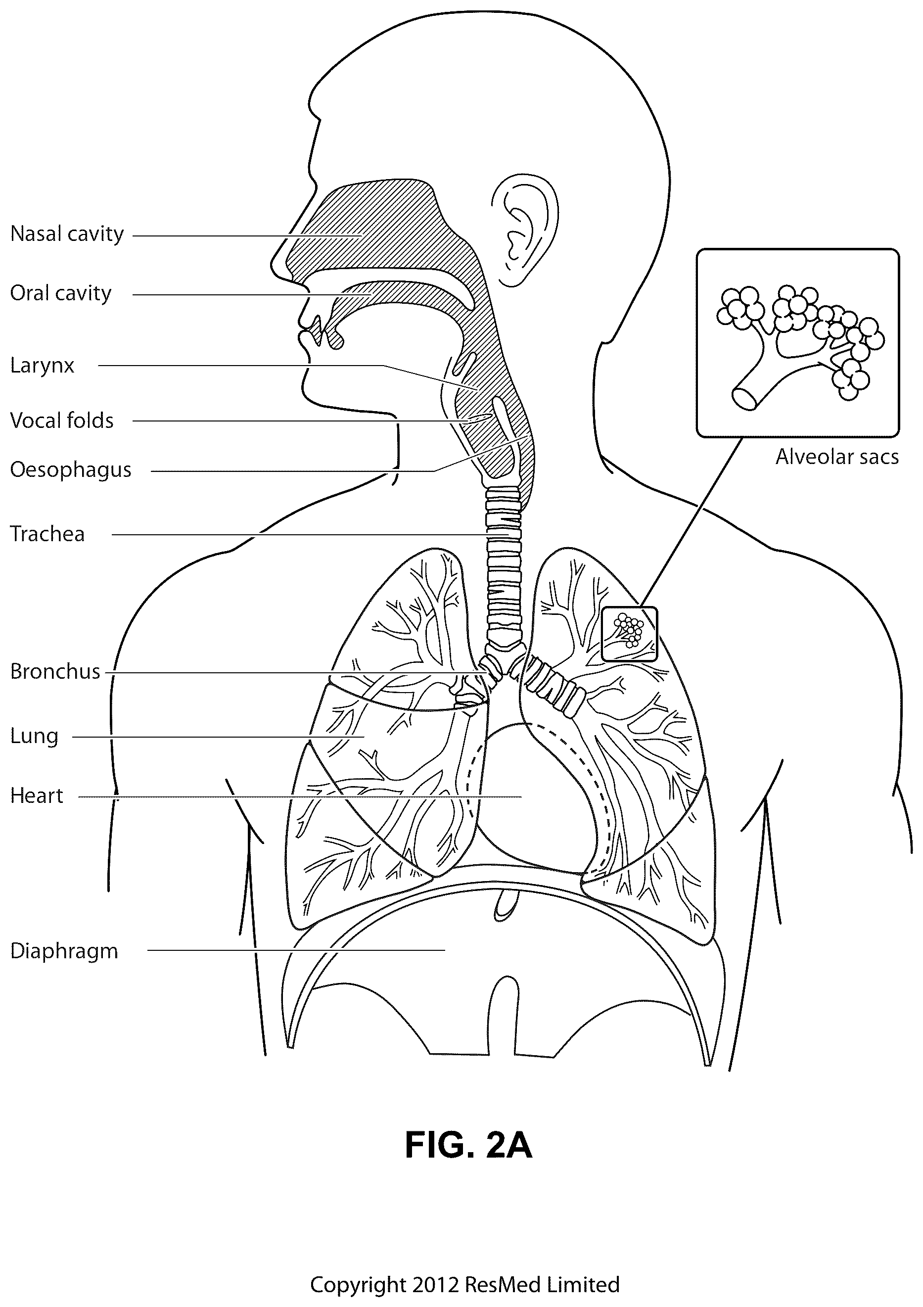 Patent US12102760 Figure 4 – Patient interface