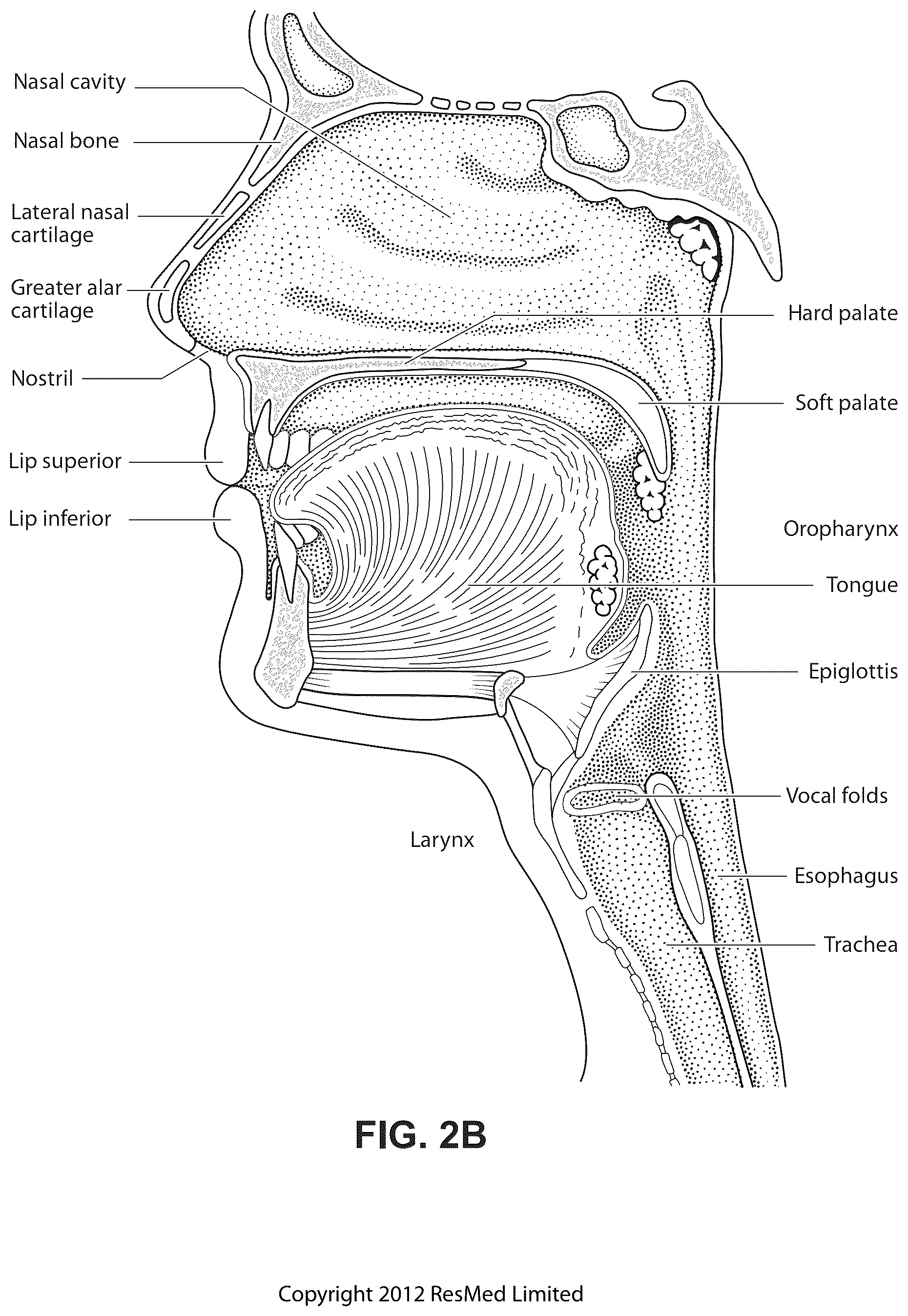 Patent US12102760 Figure 5 – Patient interface