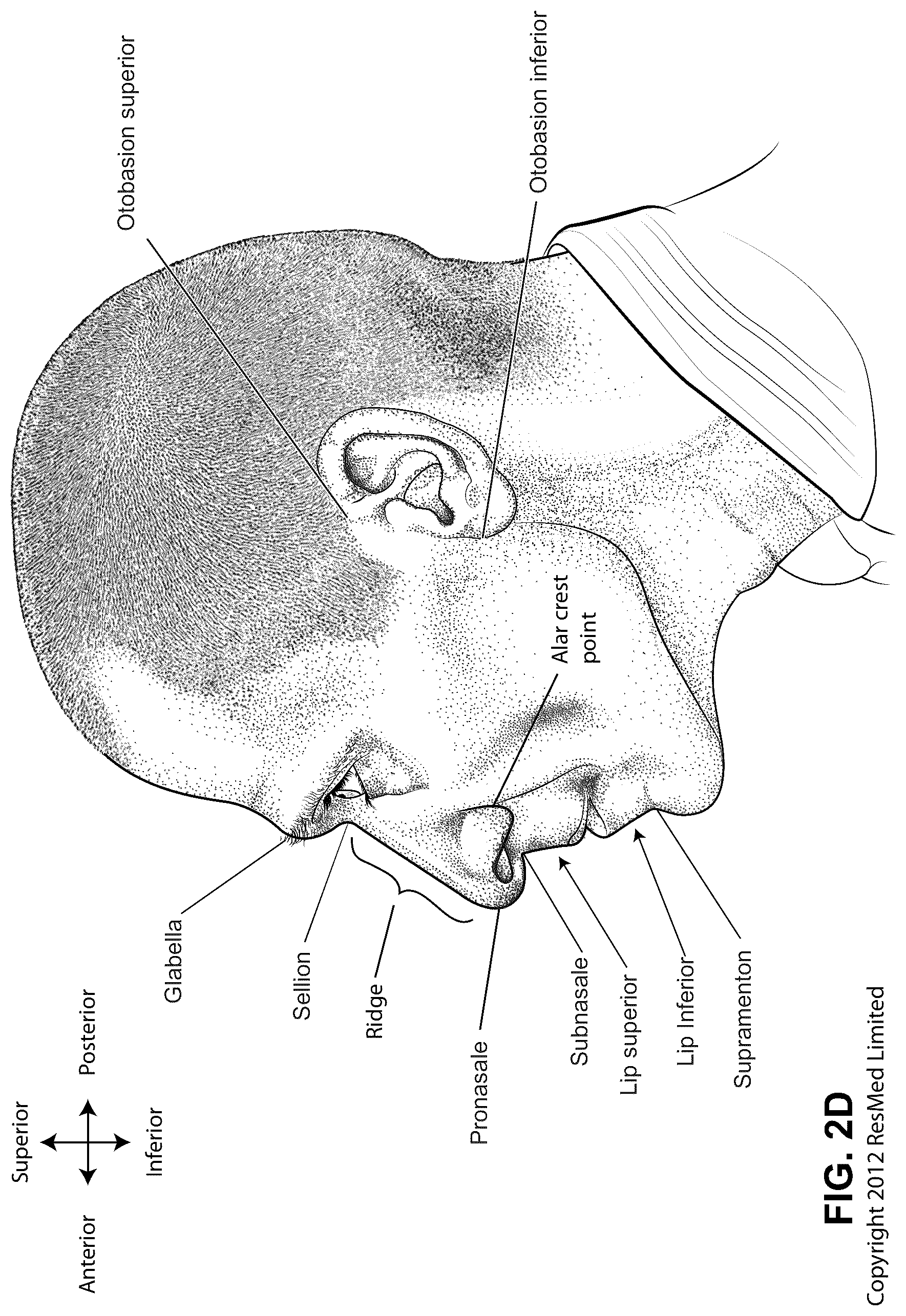 Patent US12102760 Figure 7 – Patient interface