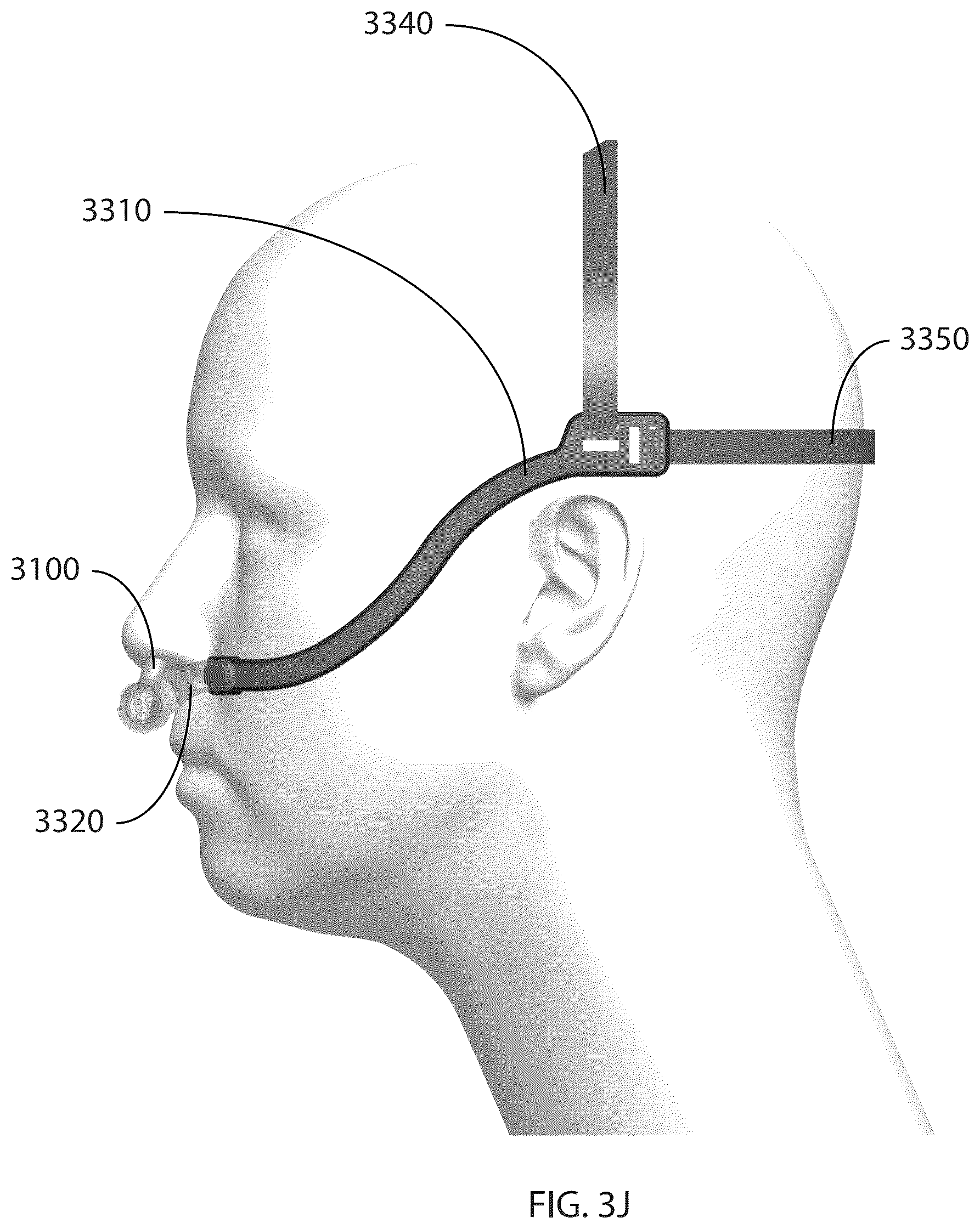 Patent US12102760 Figure 19 – Patient interface