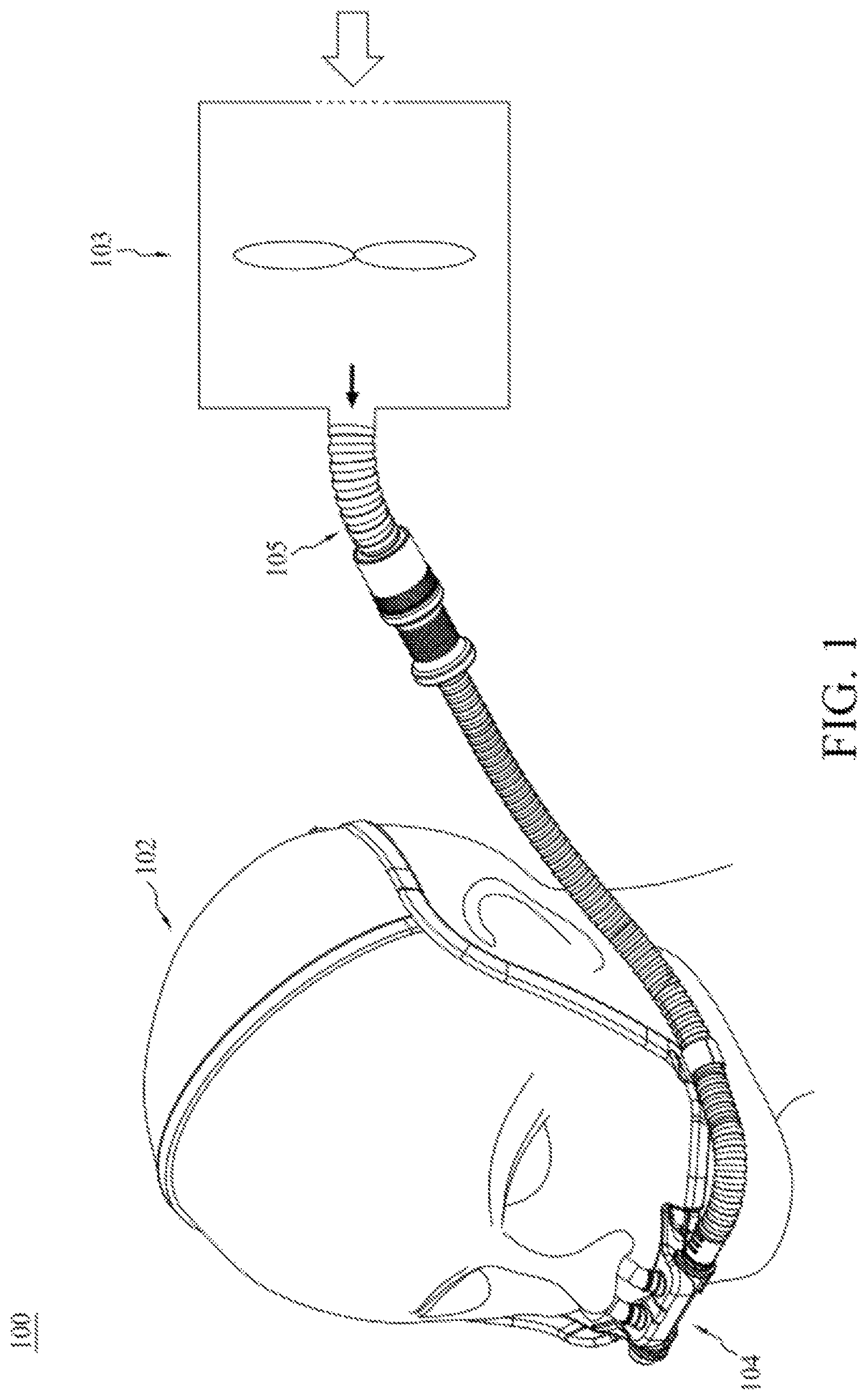 Patent US12102762 Figure 1 – Nasal cannula device