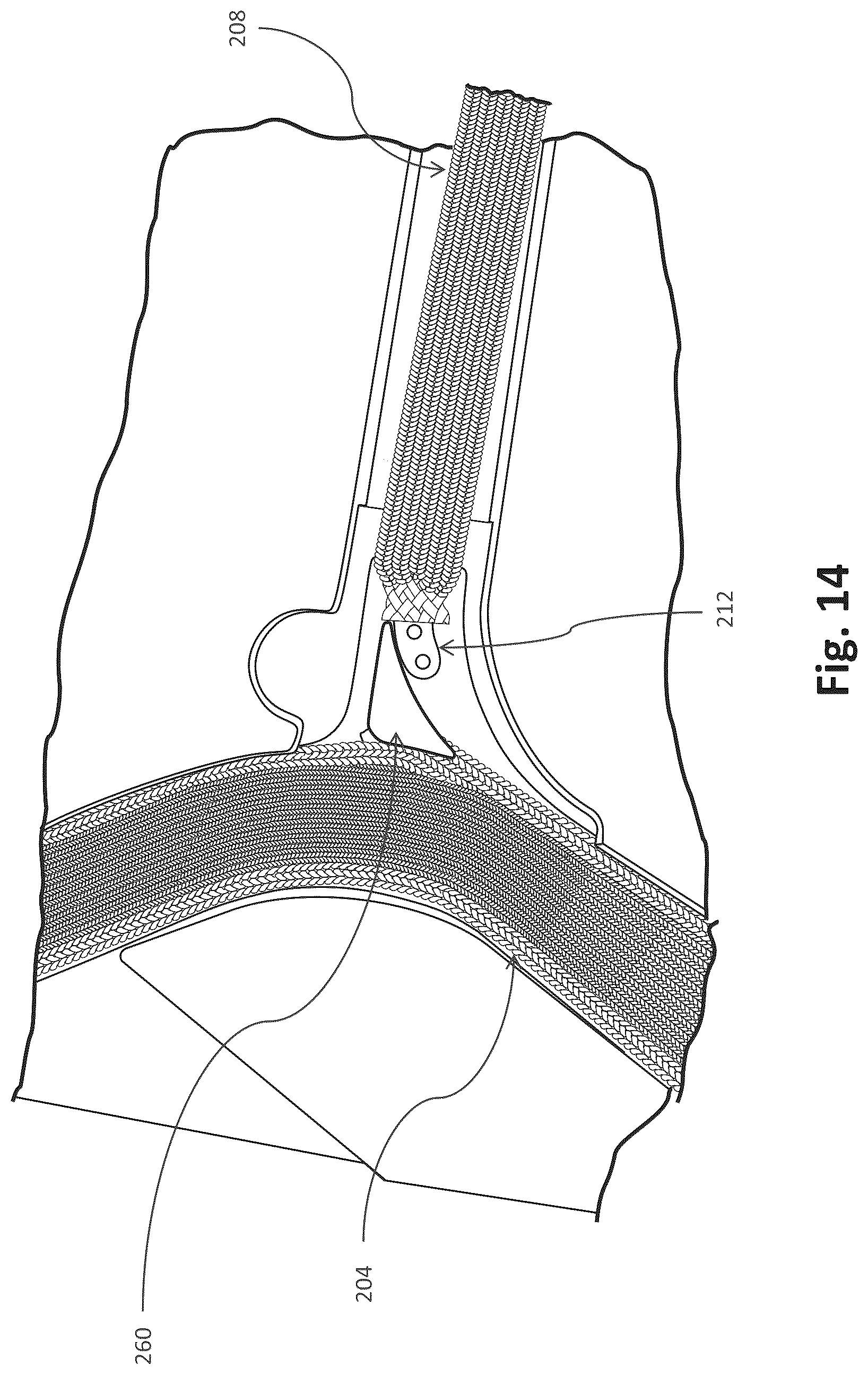 Patent US12102764 Figure 12 – Respiratory mask system