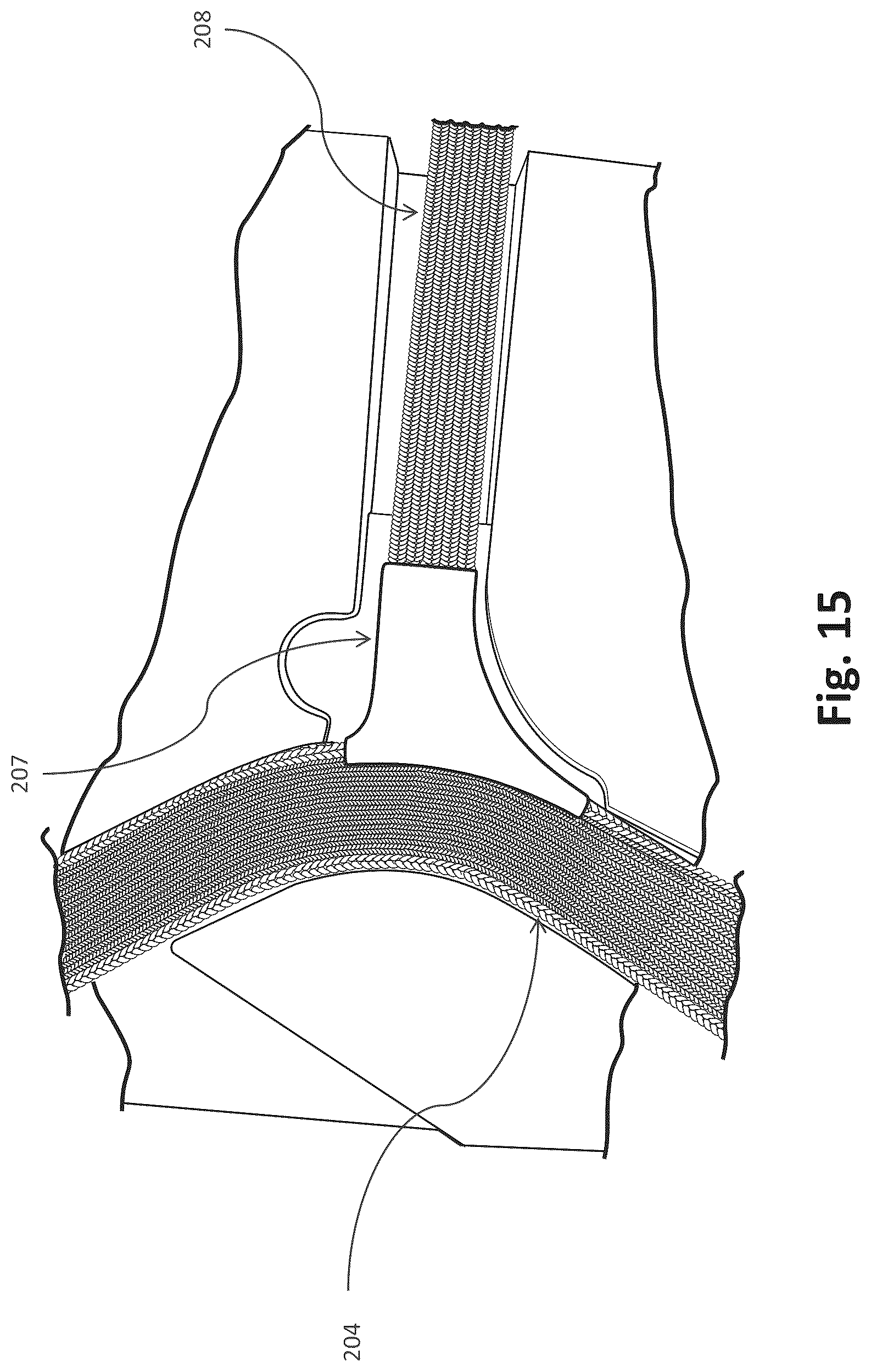 Patent US12102764 Figure 13 – Respiratory mask system