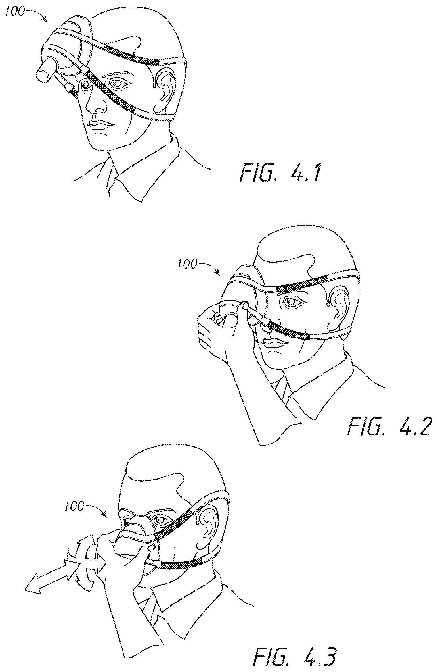 Patent US12102765 Figure 3 – Headgear assemblies and interface assemblies with headgear