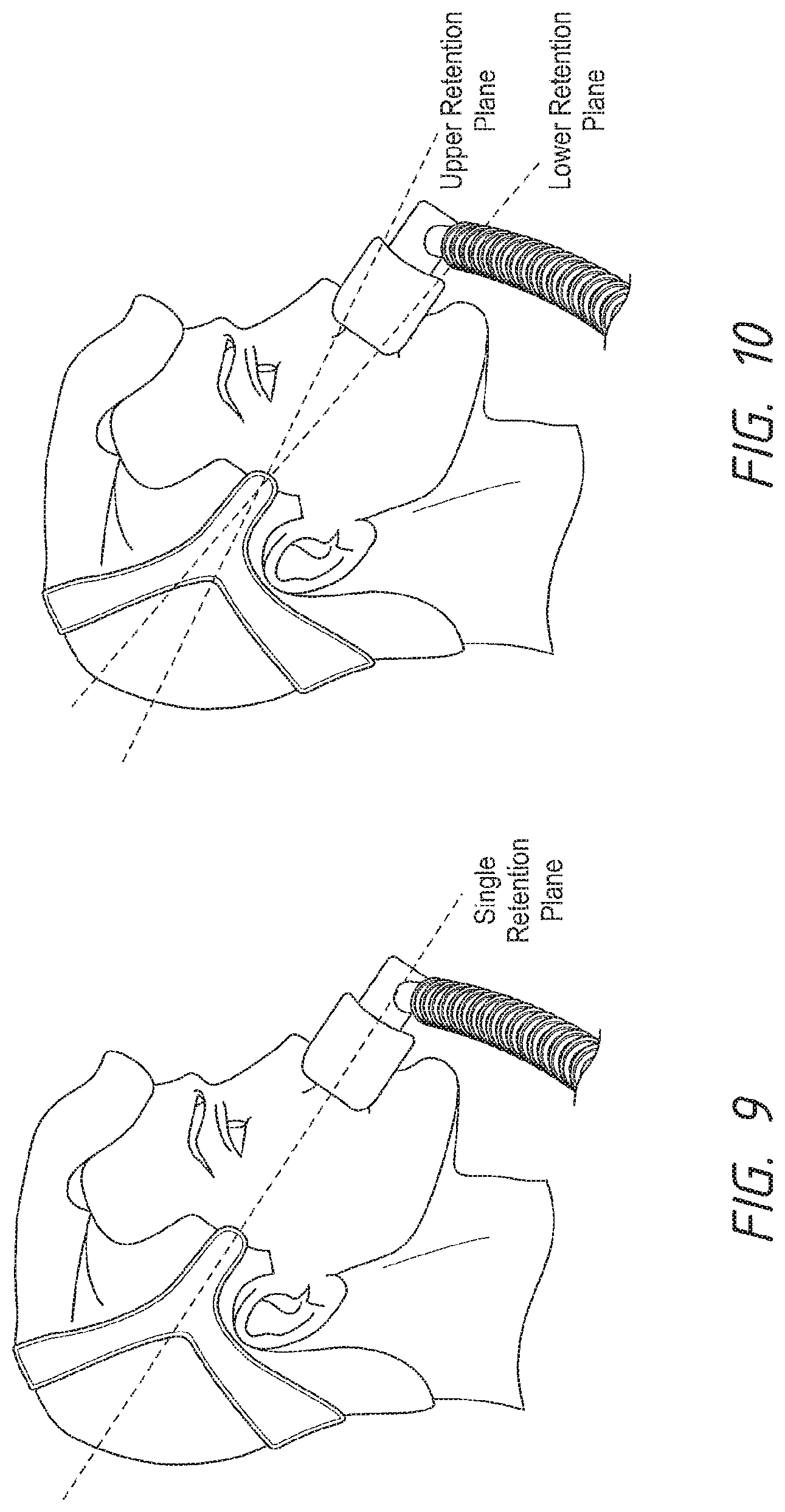Patent US12102765 Figure 8 – Headgear assemblies and interface assemblies with headgear