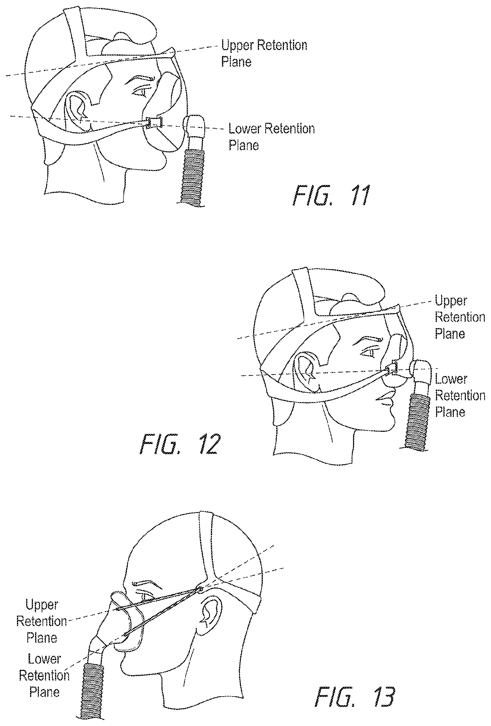 Patent US12102765 Figure 9 – Headgear assemblies and interface assemblies with headgear