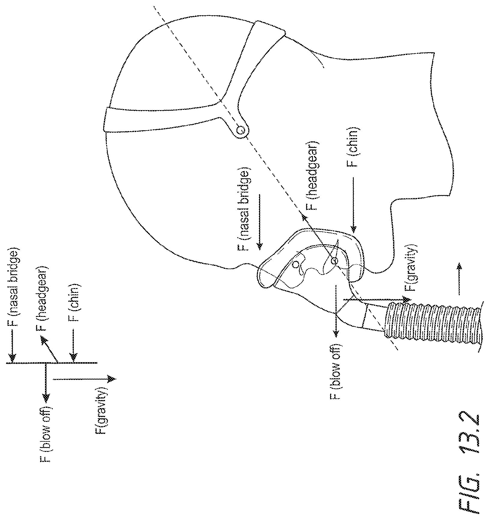 Patent US12102765 Figure 11 – Headgear assemblies and interface assemblies with headgear