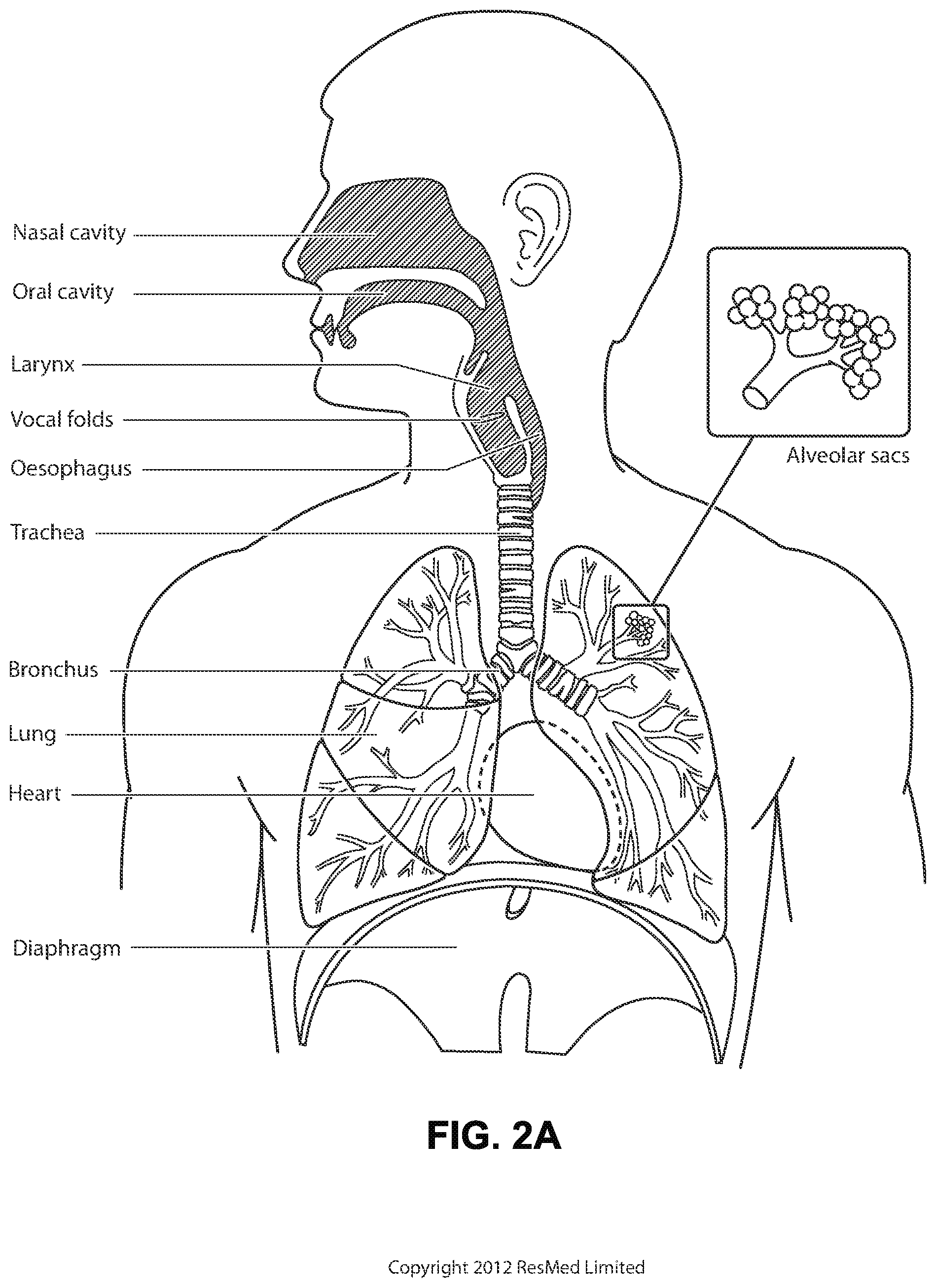 Patent US12102766 Figure 4 – Vent adaptor for patient interface system