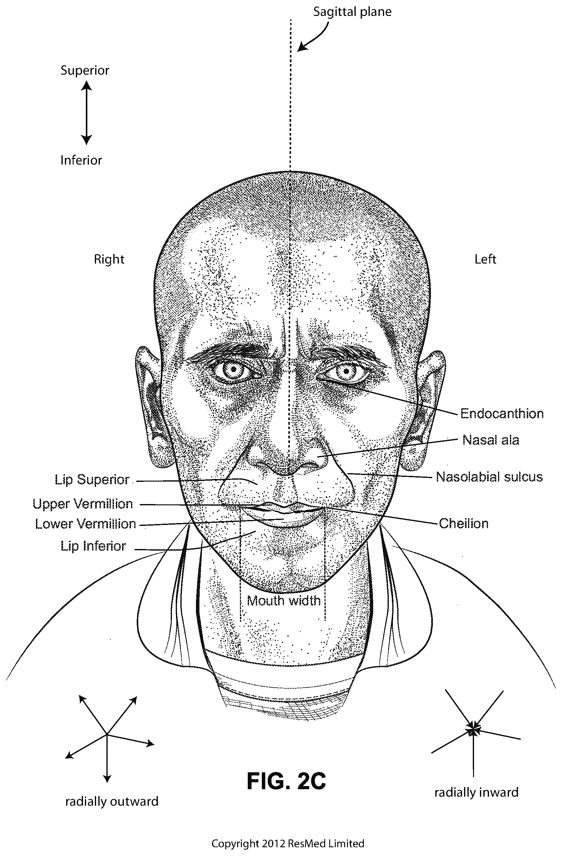 Patent US12102766 Figure 6 – Vent adaptor for patient interface system