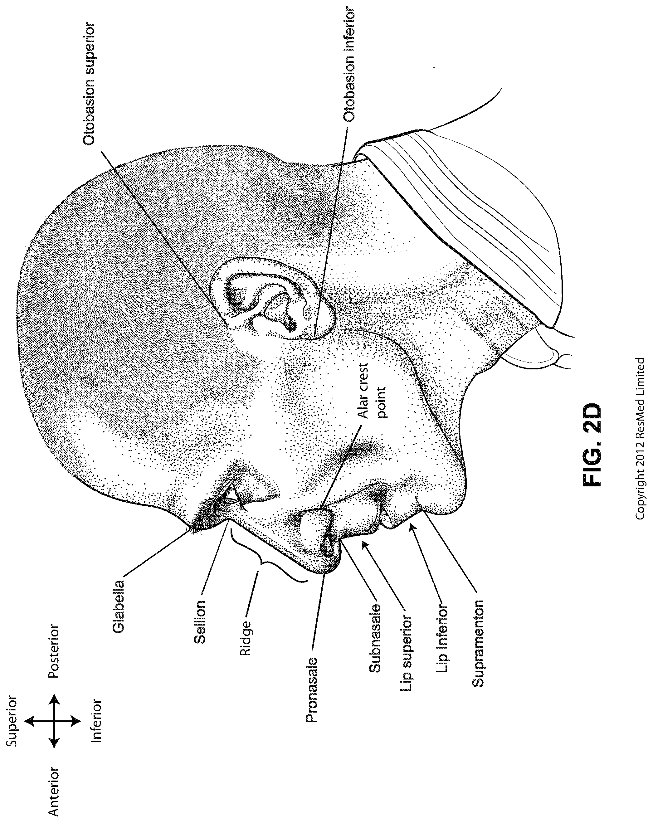 Patent US12102766 Figure 7 – Vent adaptor for patient interface system