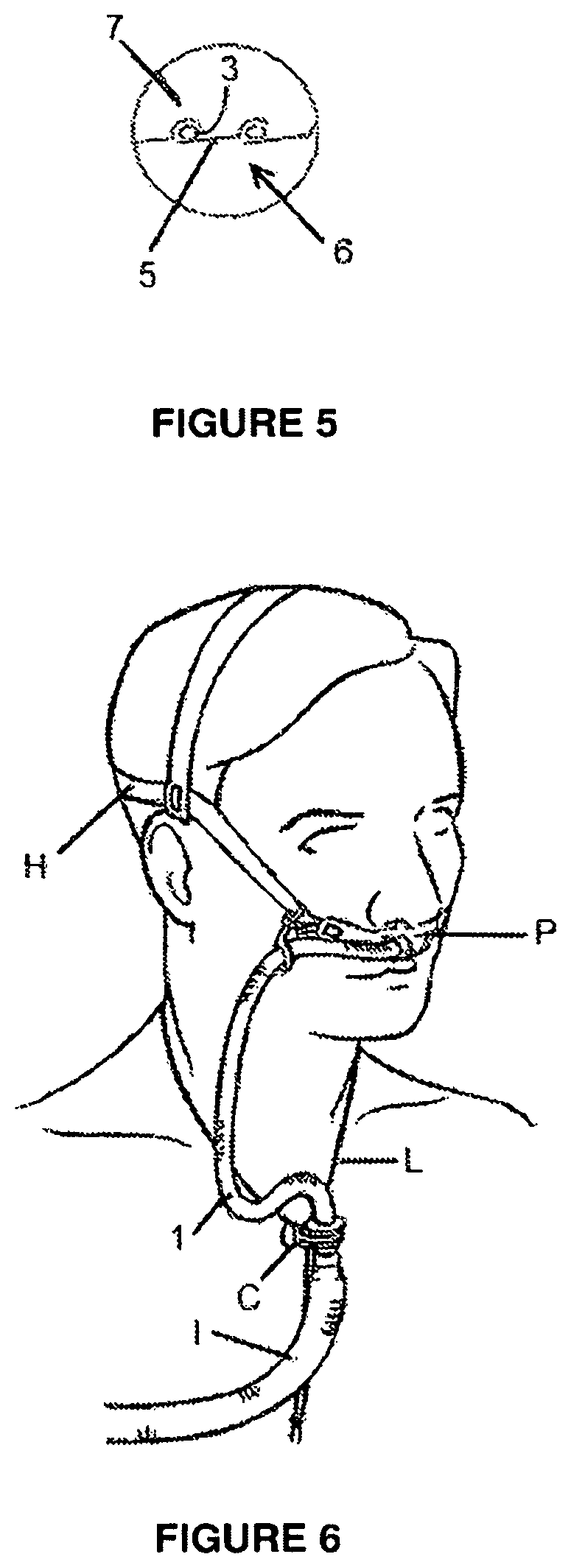 Patent US12102768 Figure 4 – Breathing circuit components for respiratory apparatus