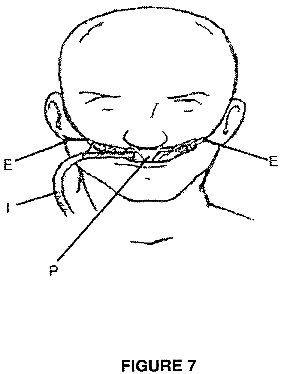 Patent US12102768 Figure 5 – Breathing circuit components for respiratory apparatus