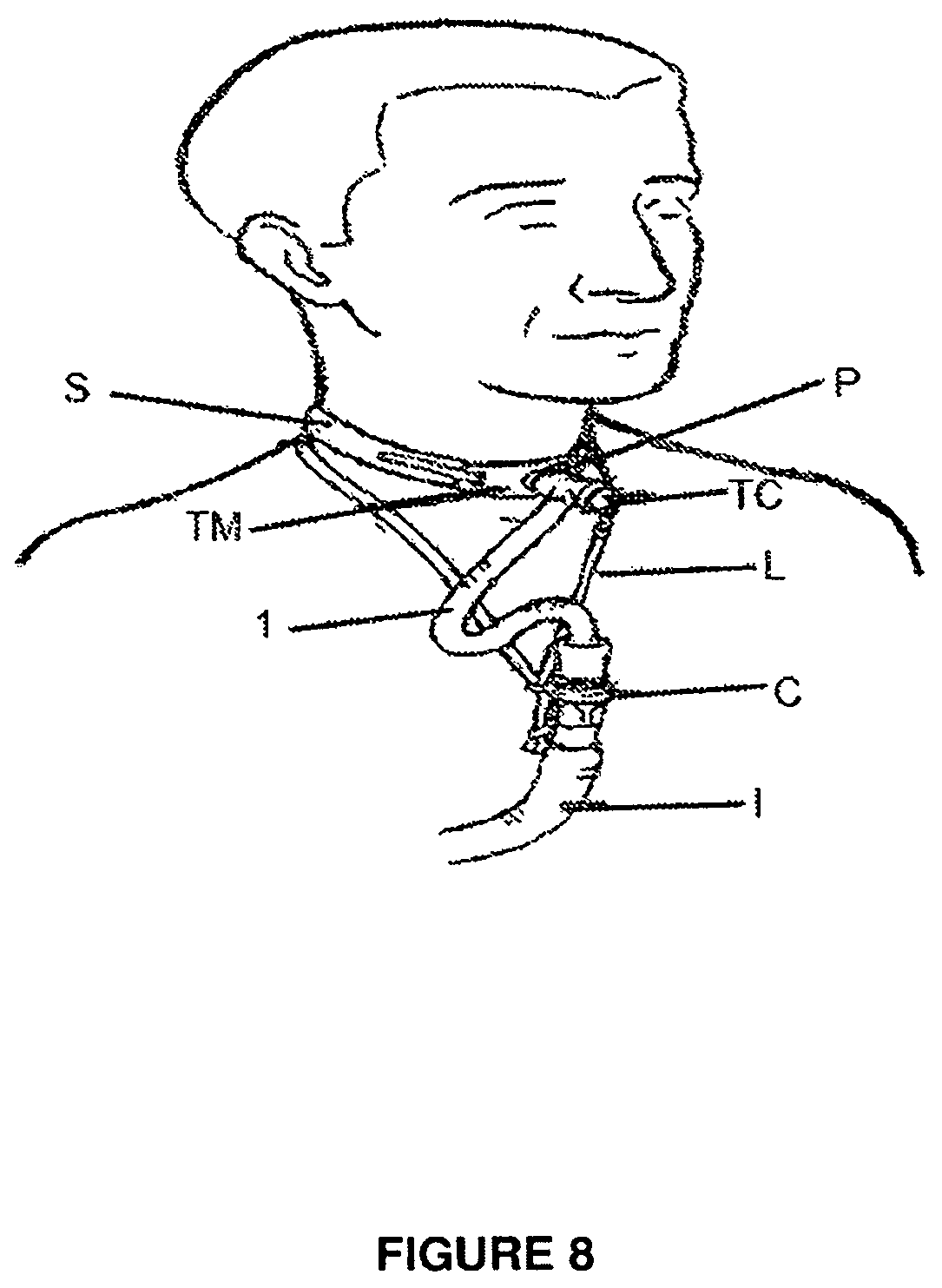 Patent US12102768 Figure 6 – Breathing circuit components for respiratory apparatus