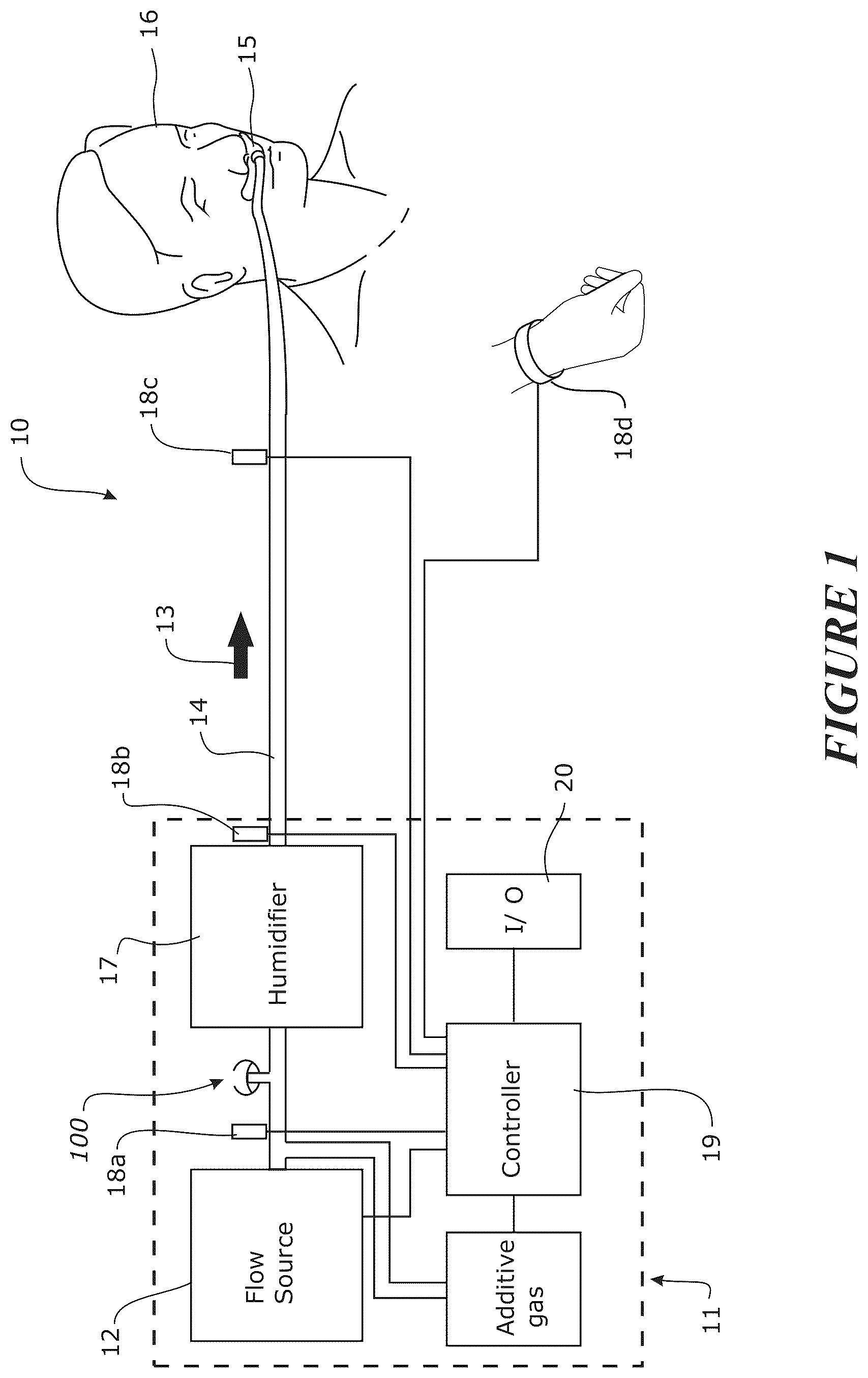 Patent US12102771 Figure 1 – Pressure regulating valve