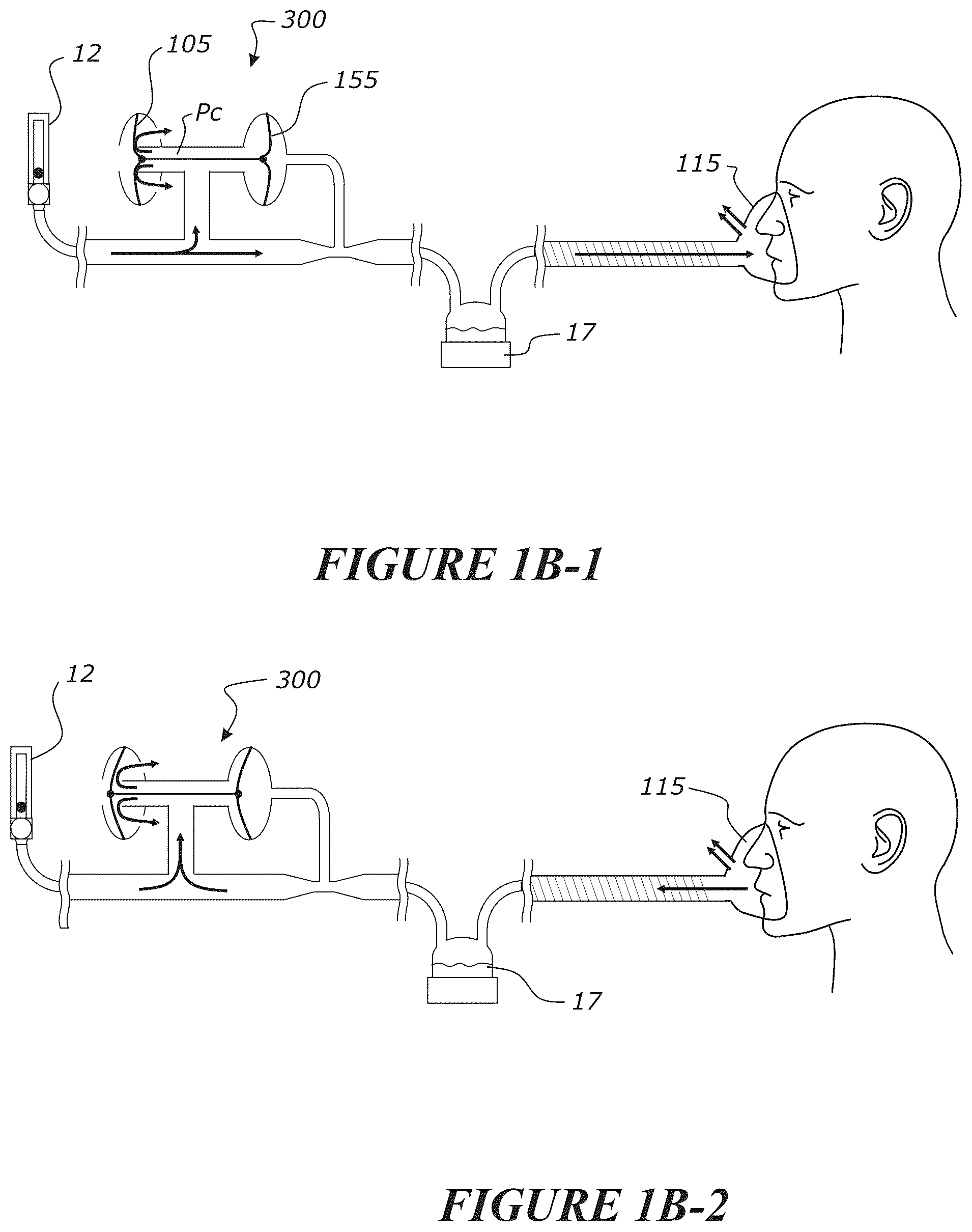 Patent US12102771 Figure 4 – Pressure regulating valve