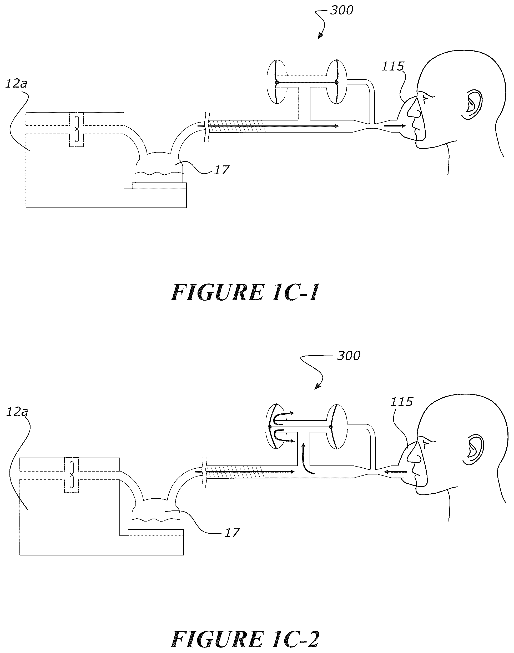 Patent US12102771 Figure 6 – Pressure regulating valve