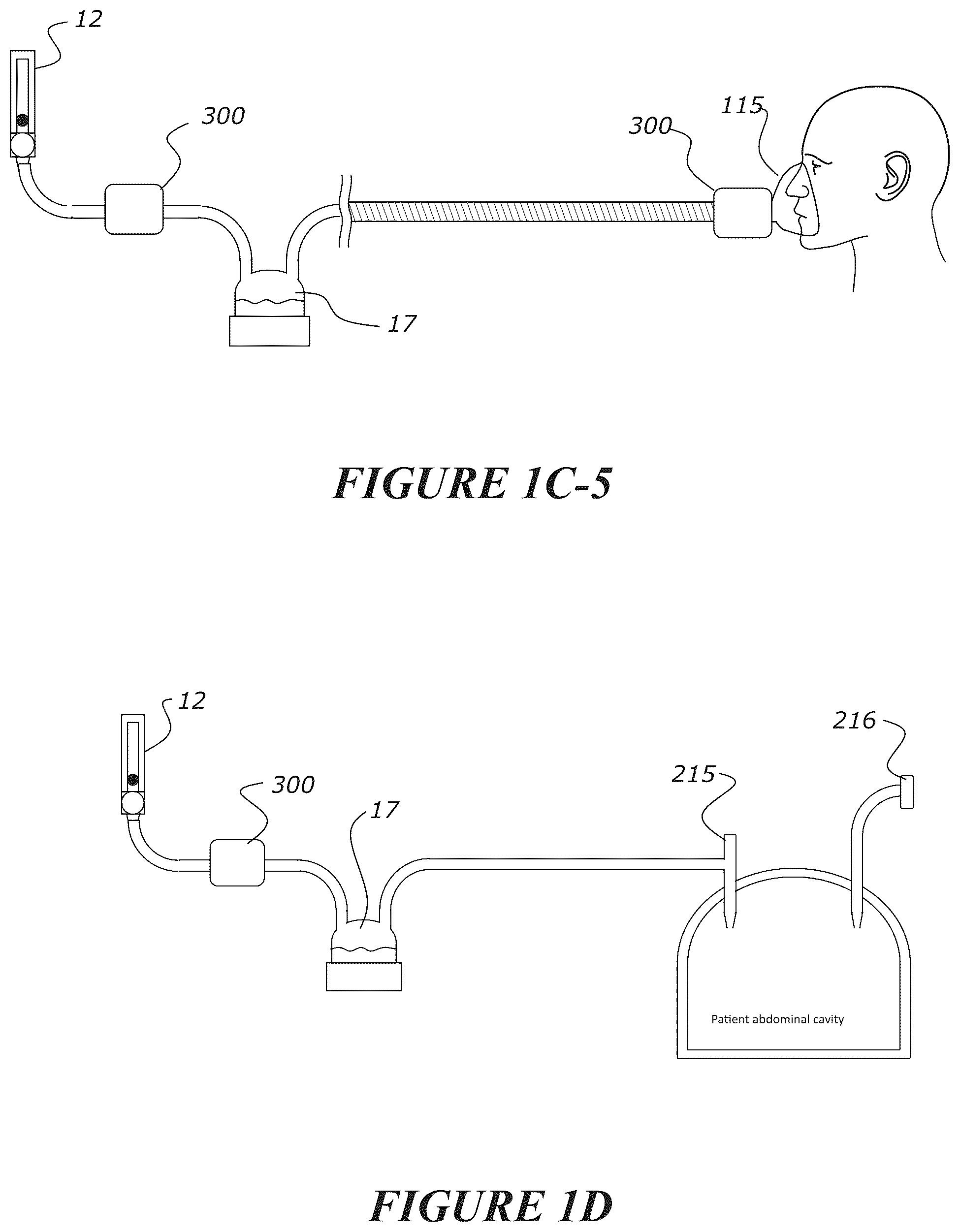 Patent US12102771 Figure 9 – Pressure regulating valve