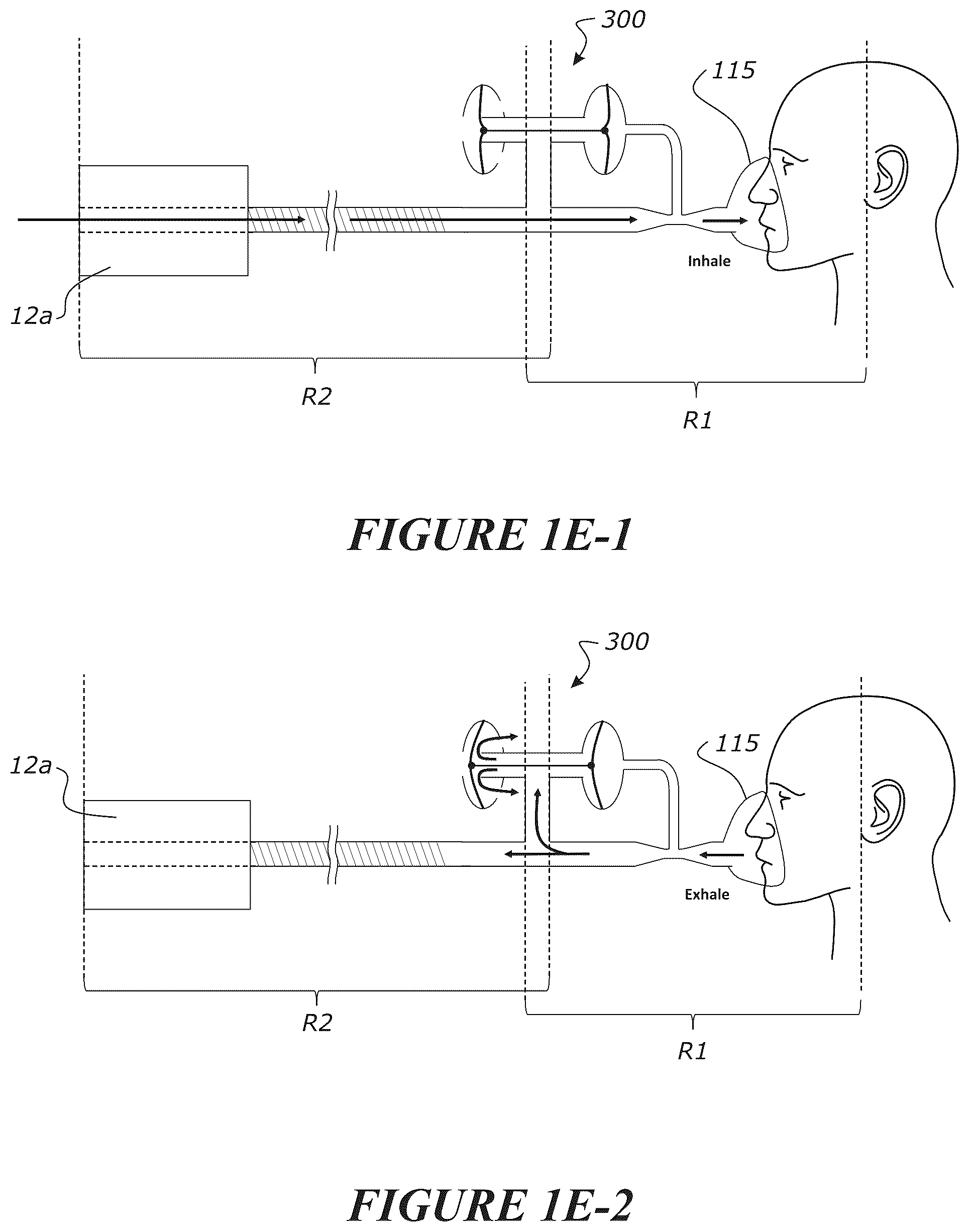 Patent US12102771 Figure 10 – Pressure regulating valve