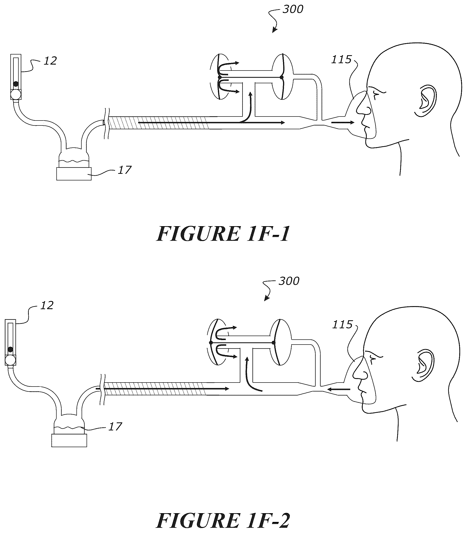 Patent US12102771 Figure 11 – Pressure regulating valve