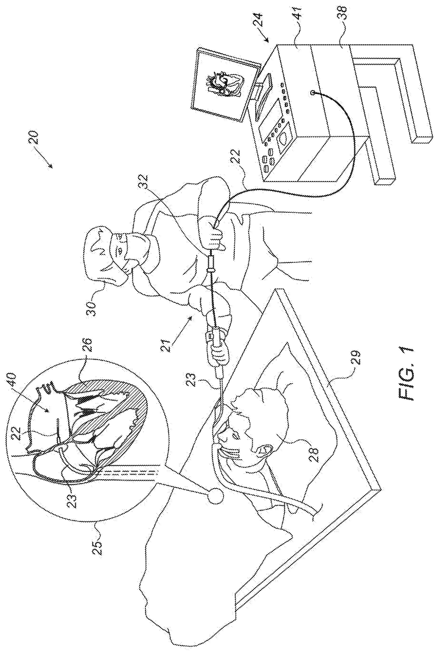 Patent US12102773 Figure 1 – Catheter elements for bond-strength enhancement