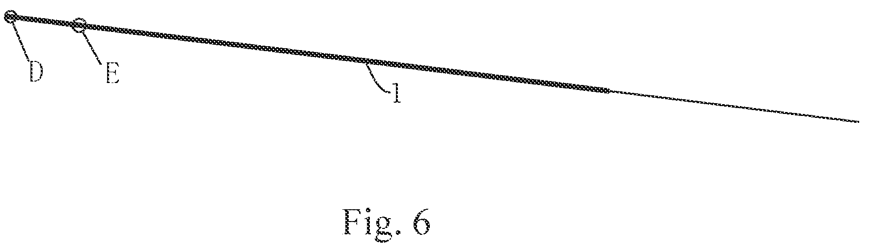 Patent US12102775 Figure 6 – Ureteral catheter structure