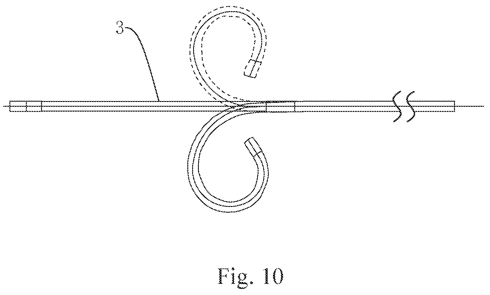 Patent US12102775 Figure 10 – Ureteral catheter structure