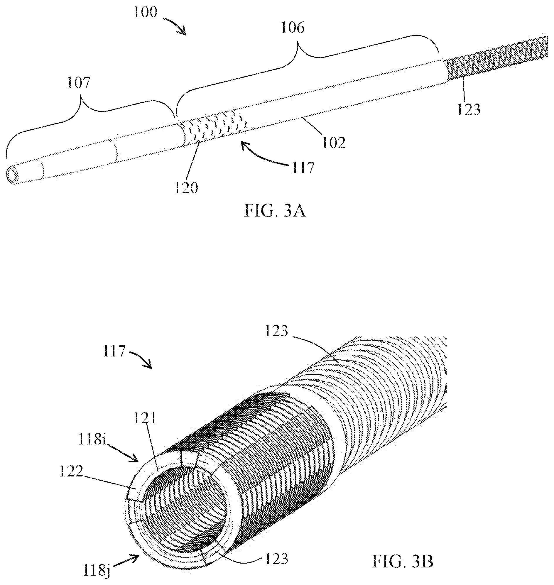 Patent US12102776 Figure 2 – Embolization microcatheter head having slitted pattern