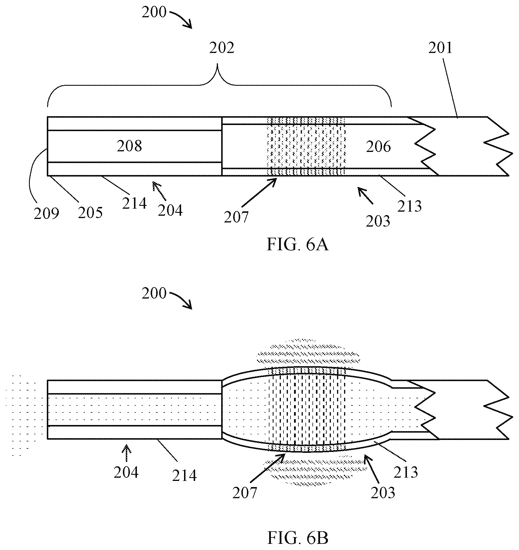 Patent US12102776 Figure 5 – Embolization microcatheter head having slitted pattern