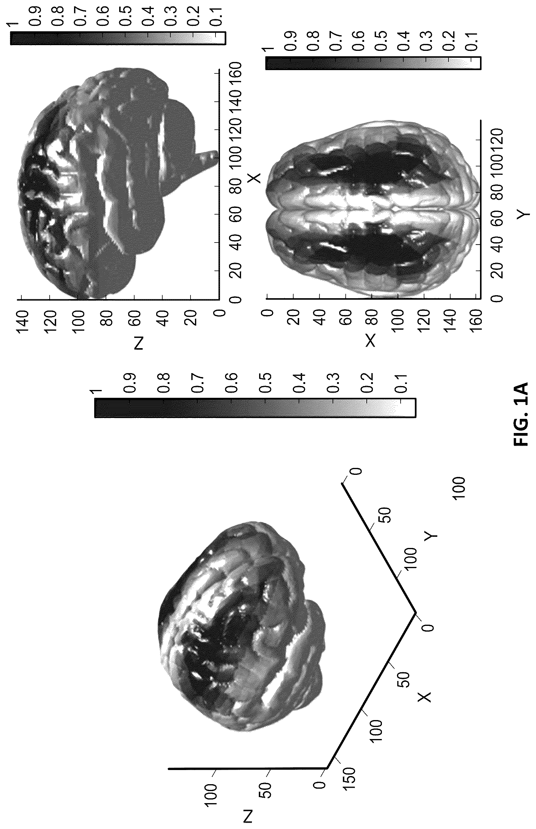 Patent US12102777 Figure 1 – Devices and methods for transvascular drainage of fluids in an intracranial extravascular space