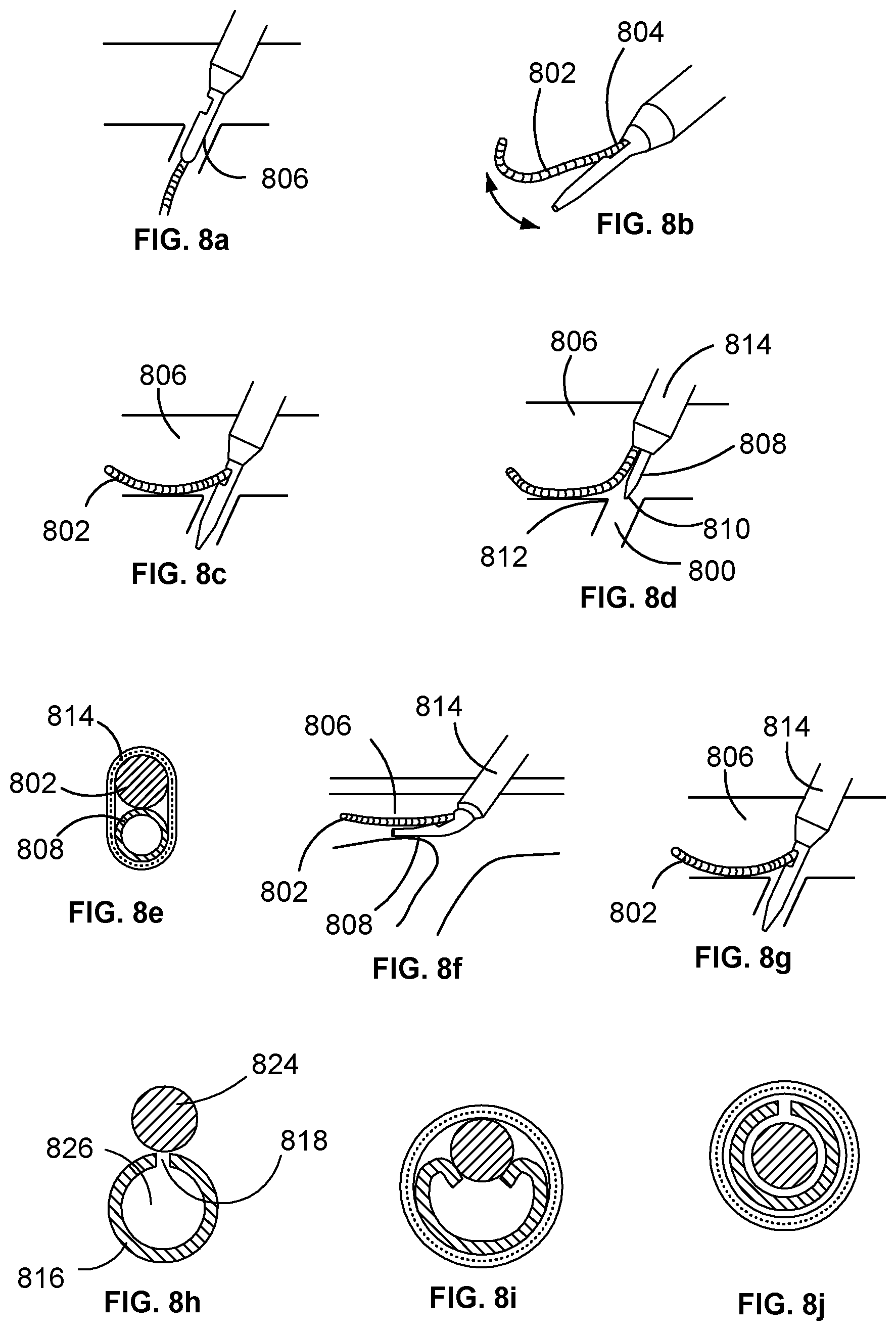 Patent US12102779 Figure 4 – Obturator, sheath and method for using same
