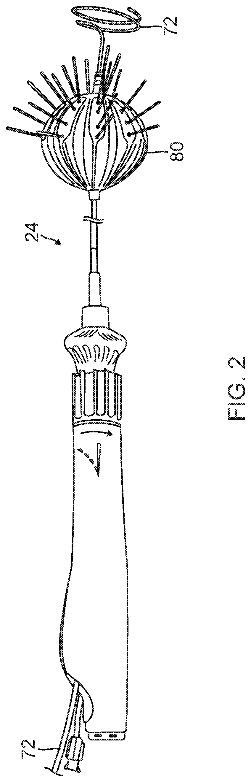 Patent US12102781 Figure 2 – Reinforcement for irrigated electrophysiology balloon catheter with flexible-circuit electrodes