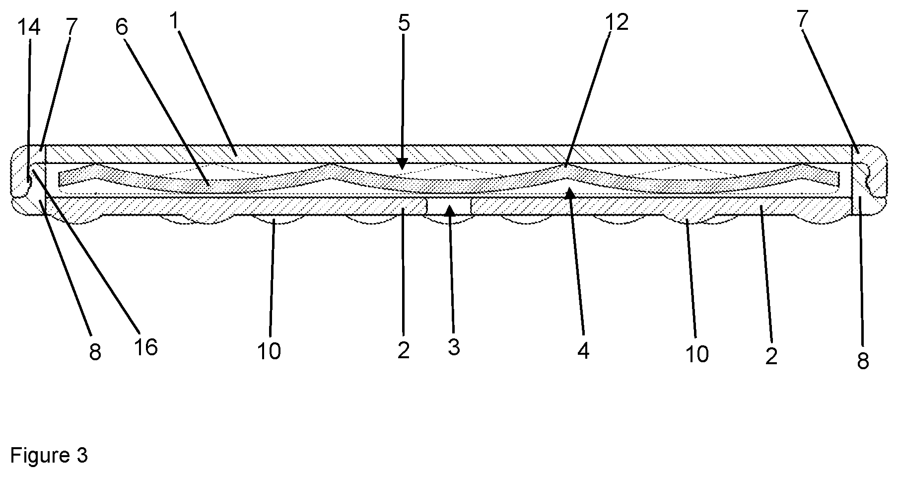 Patent US12102784 Figure 3 – Implant for local active ingredient release