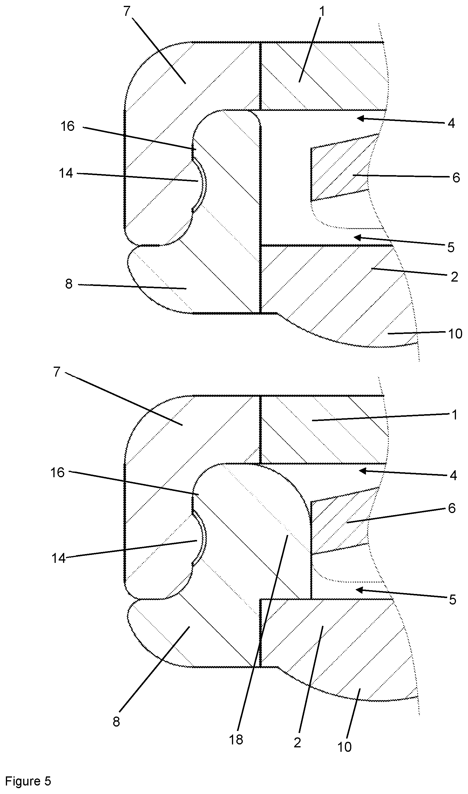 Patent US12102784 Figure 5 – Implant for local active ingredient release