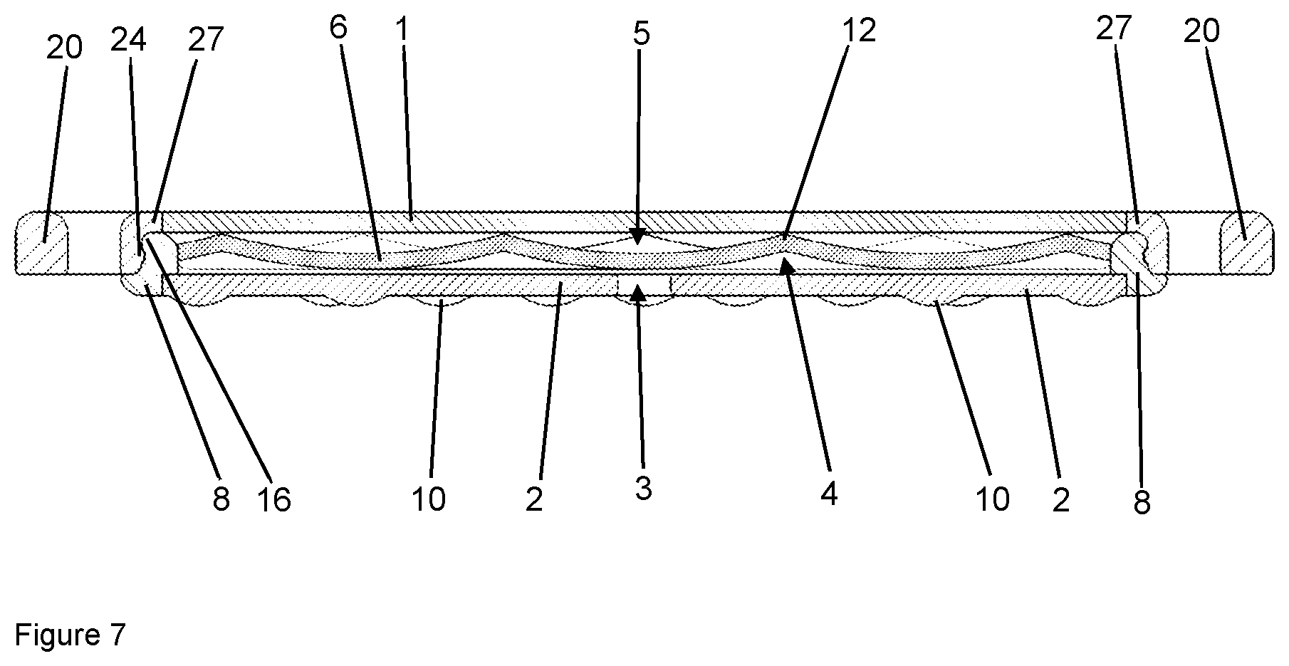 Patent US12102784 Figure 7 – Implant for local active ingredient release