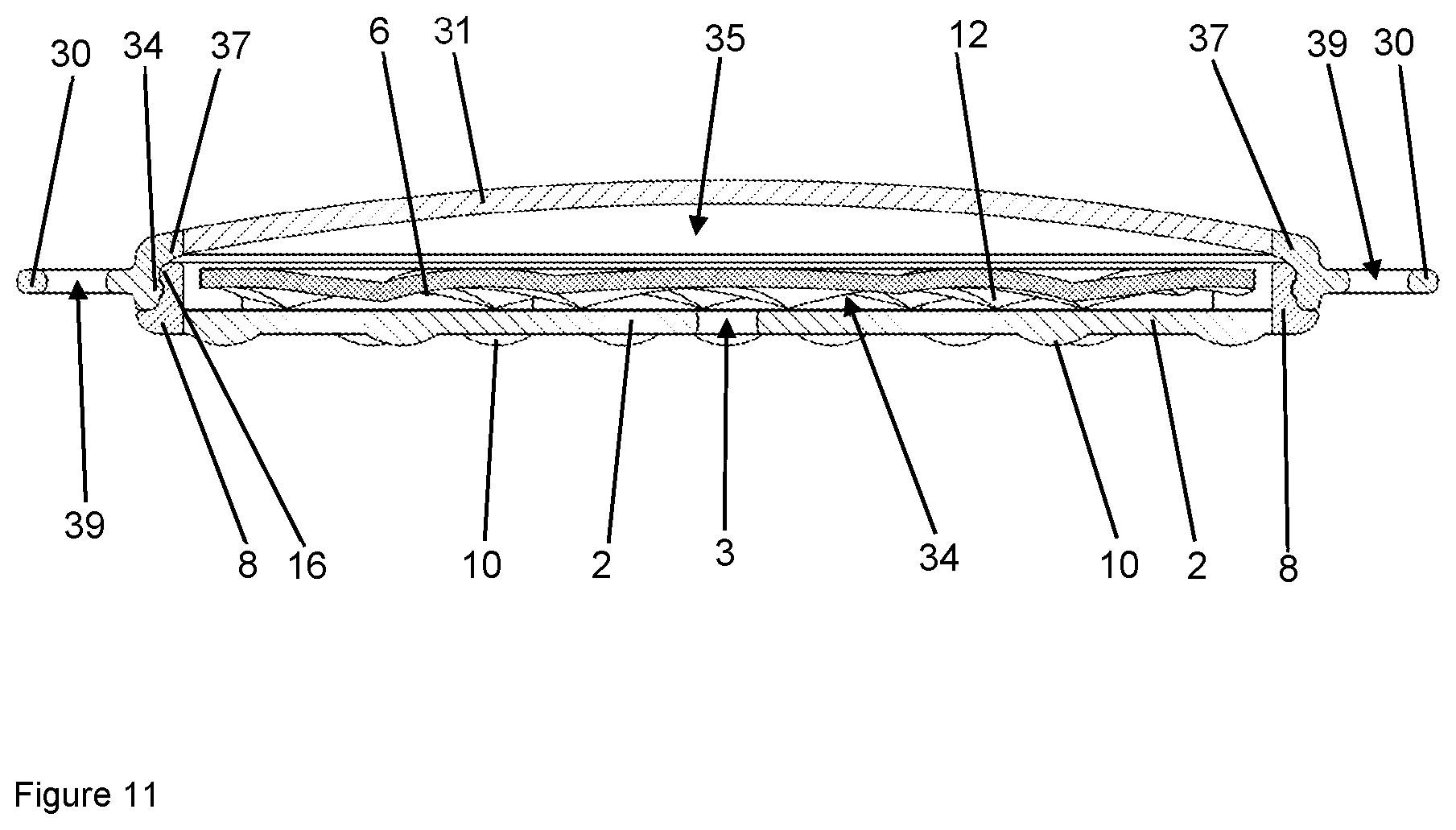 Patent US12102784 Figure 11 – Implant for local active ingredient release