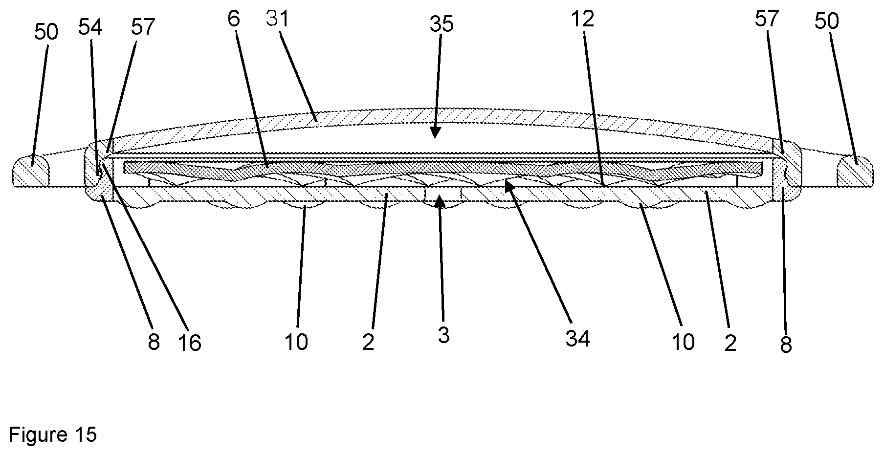 Patent US12102784 Figure 15 – Implant for local active ingredient release