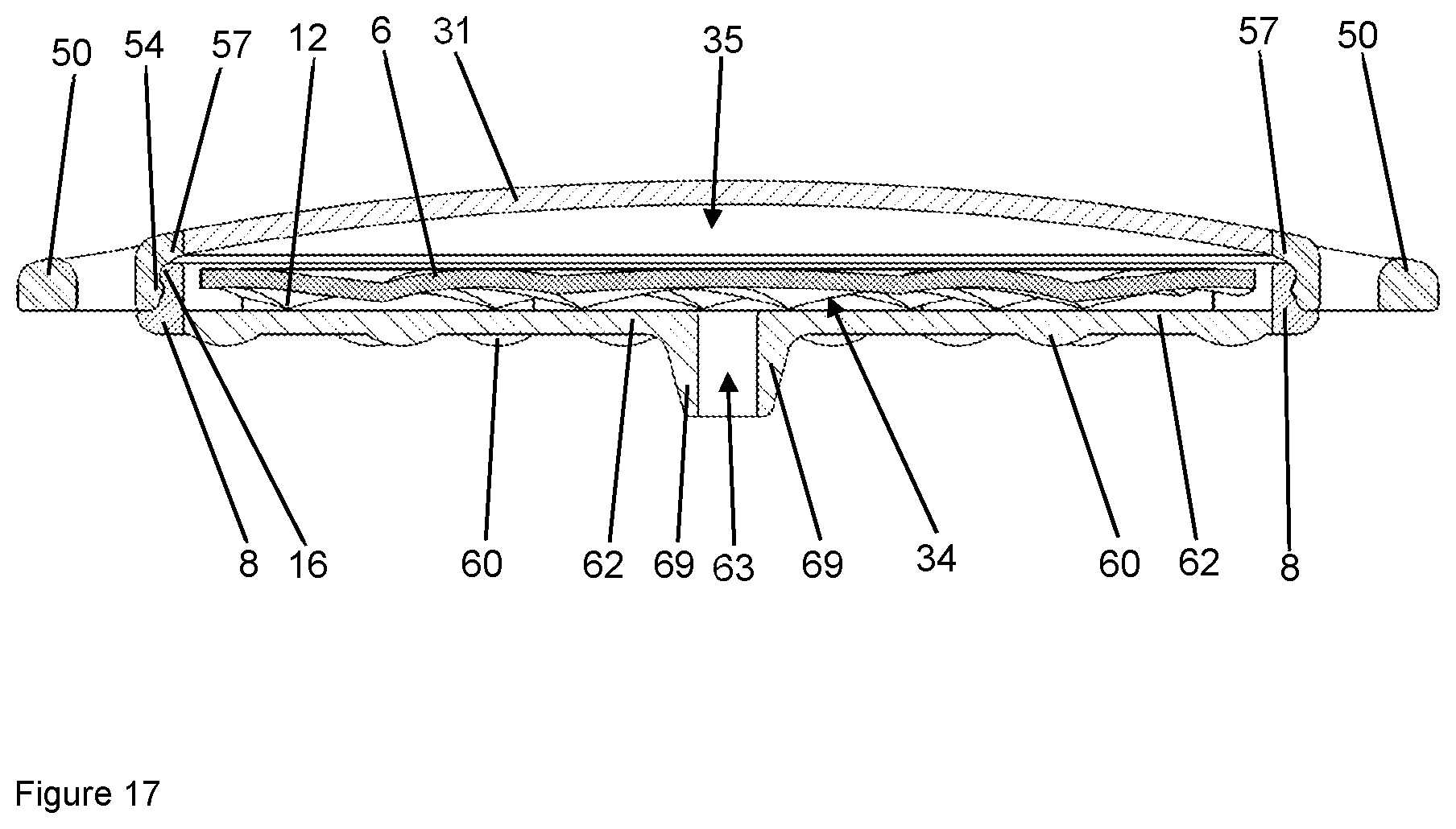 Patent US12102784 Figure 17 – Implant for local active ingredient release