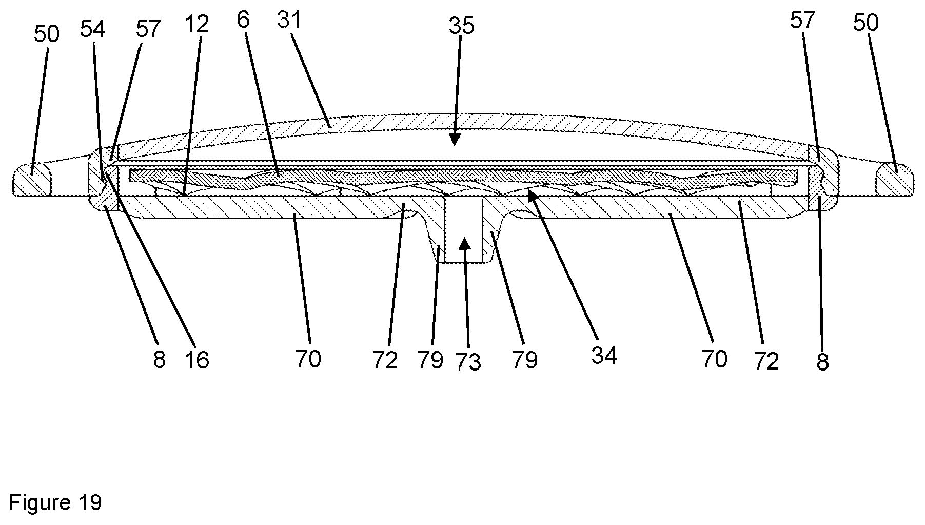 Patent US12102784 Figure 19 – Implant for local active ingredient release