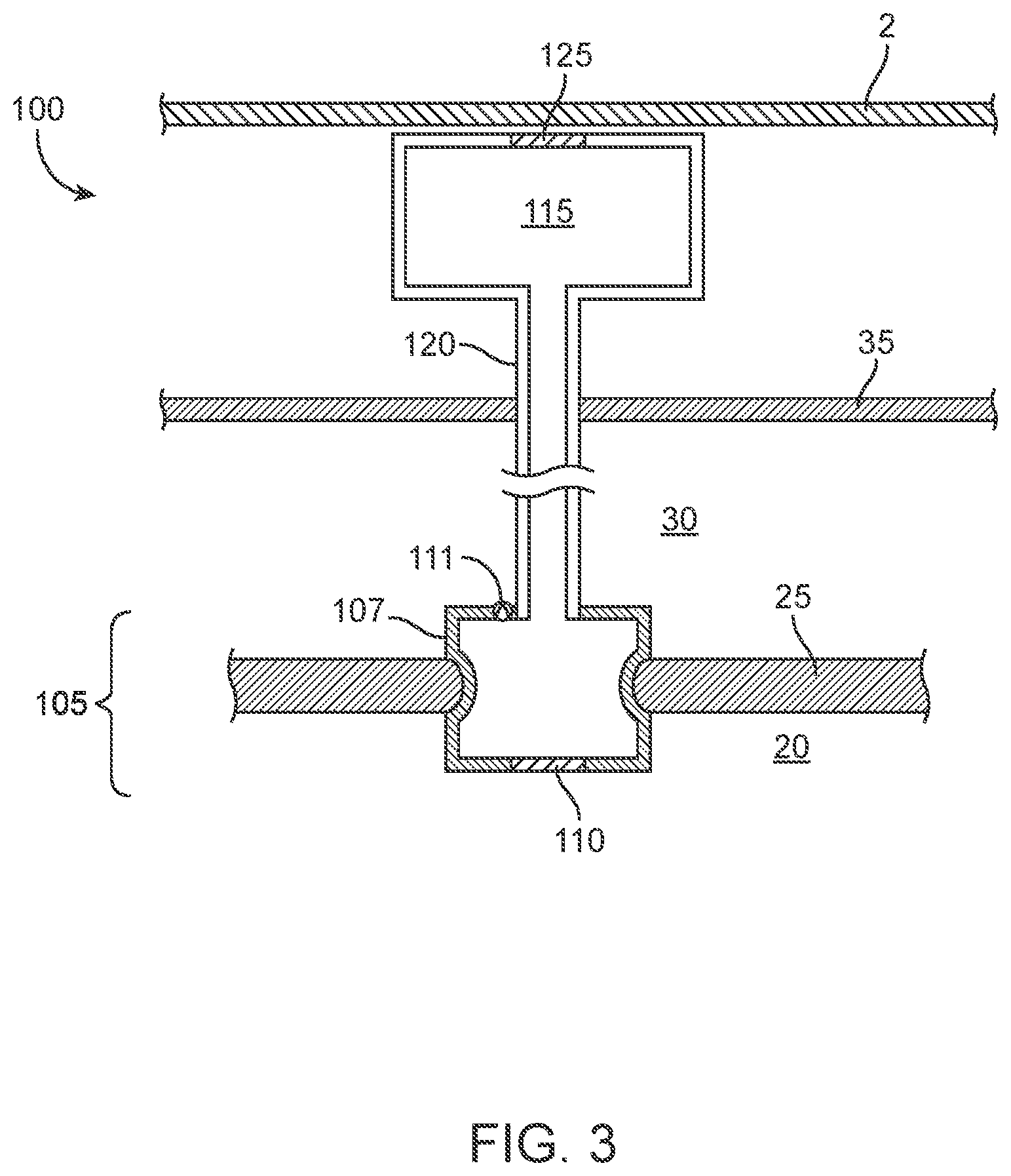 Patent US12102785 Figure 3 – Inner ear drug delivery devices and methods of use