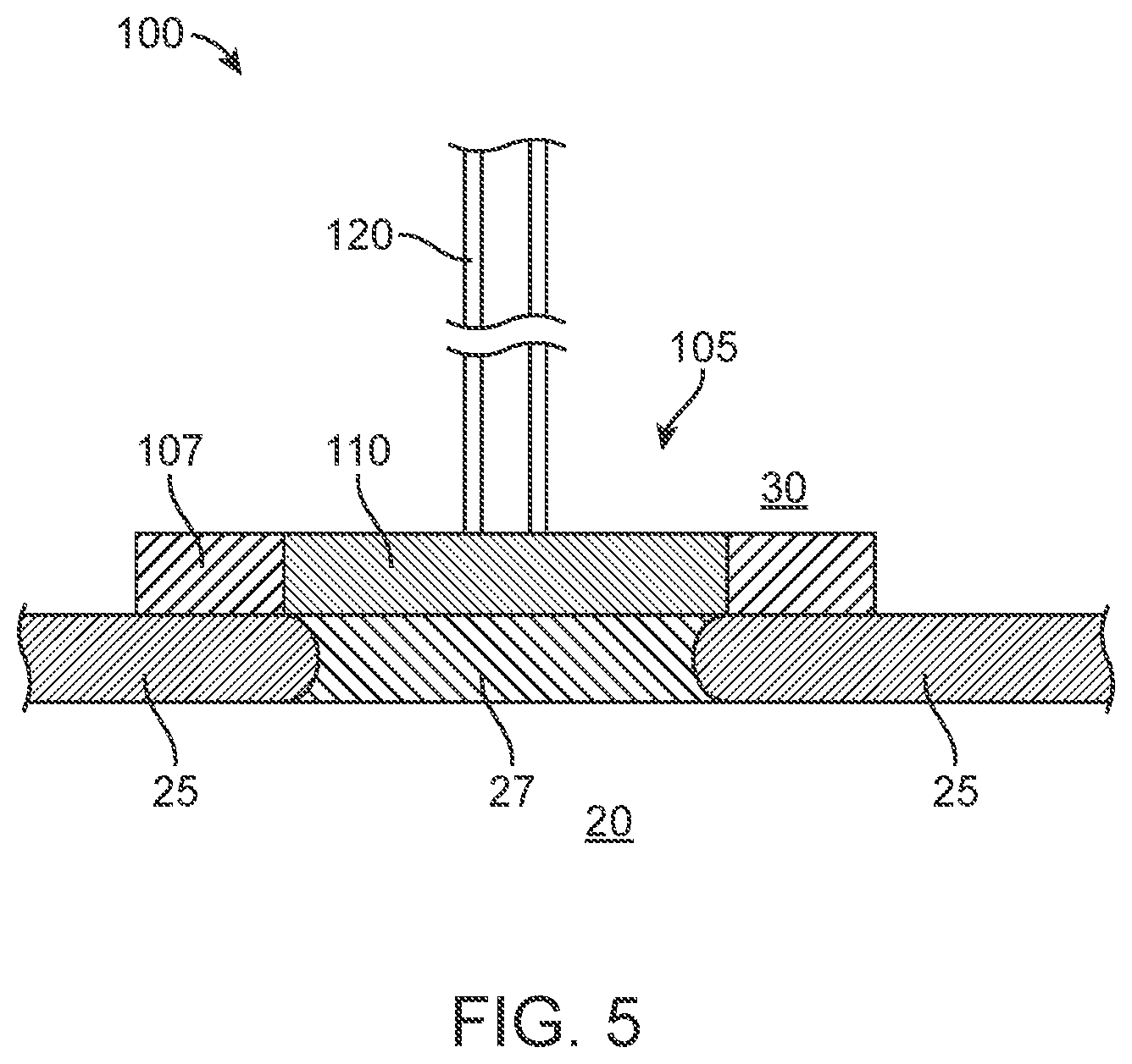 Patent US12102785 Figure 5 – Inner ear drug delivery devices and methods of use
